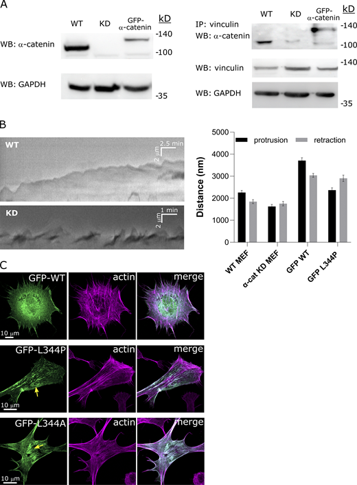 α-Catenin regulates cell edge protrusion-retraction cycles and cytoskeletal organization. (A) Left: Immunoblot for α-catenin in lysates taken from WT MEFs, α-catenin KD MEFs, and α-catenin KD MEFs expressing WT GFP-α-catenin. Right: Immunoprecipitation for vinculin followed by immunoblot for α-catenin; below is a blot for vinculin from the cell lysates. WB, Western blot. (B) Left: Kymographs of the cell edge taken from time-lapse videos of early spreading by WT and α-catenin KD MEFs showing regular protrusion-retraction cycles in the former and extensive ruffling in the latter. Right: quantifications of the distances traveled during the protrusion and retraction phases by WT MEFs, α-catenin KD MEFs, α-catenin KD MEFs expressing WT GFP-α-catenin, and α-catenin KD MEFs expressing GFP-α-catenin L344P. WT and GFP-WT cells display longer protrusions than retractions, whereas KD and L344P cells do not, consistent with ruffling. n > 30 cycles from at least eight cells in each case. (C) F-actin staining (phalloidin) in vinculin−/− MEF cells expressing WT GFP-α-catenin, GFP-α-catenin L344P, and GFP-α-catenin L344A. The yellow arrows point to actin aggregates near the cell center. Source data are available for this figure: SourceData FS3.