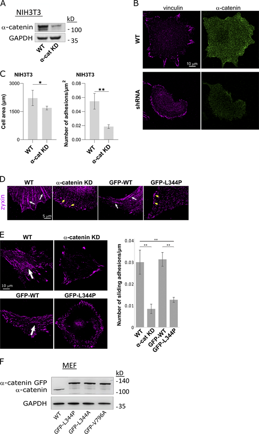 α-Catenin regulates adhesion maturation. (A) Immunoblot for α-catenin showing KD in NIH3T3 cells. (B) Immunostaining for vinculin and α-catenin in WT and α-catenin KD NIH3T3 cells. (C) Quantification of cell area and number of mature adhesions per square micrometer in WT and α-catenin KD NIH3T3 cells. n = 17 cells in each case. (D) Immunostaining for zyxin shows the presence of mature adhesions in WT MEFs and α-catenin KD cells expressing WT GFP-α-catenin (white arrows), but only the presence of focal complexes in α-catenin KD cells and α-catenin KD cells expressing GFP-α-catenin L344P (yellow arrows). (E) Formation of sliding adhesions (arrows) on Matrigel-coated coverslips by WT cells, α-catenin KD cells, and α-catenin KD cells expressing WT GFP-α-catenin or GFP-α-catenin L344P (n > 15 cells in each case). (F) Immunoblot for α-catenin in WT MEFs and α-catenin KD cells expressing GFP-α-catenin L344P, GFP-α-catenin L344A, and GFP-α-catenin V796A. Statistical analysis for the NIH3T3 cell area and number of adhesions was performed with two-tailed unpaired t test followed by Welch’s correction. Statistical analysis of the number of sliding adhesions was performed by ANOVA followed by Tukey’s post hoc test correction (*, P < 0.05; **, P < 0.01). Source data are available for this figure: SourceData FS4.