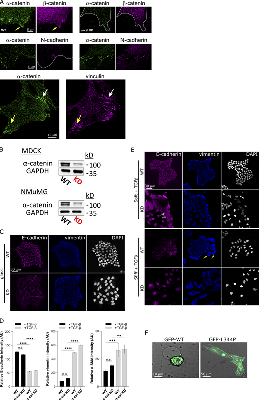 α-Catenin plays a role in TGF-β-induced EMT. (A) Top: α-Catenin and β-catenin localize at the cell edge, but β-catenin is missing from the edge upon α-catenin KD. Middle: N-cadherin is localized in cell–cell junctions (right) but not at the cell edge (left) in WT MEFs. Bottom: Mature FAs (yellow arrow) form in extensions rich with α-catenin in cells that also form α-catenin–rich cell–cell contacts (white arrow). (B) Immunoblot for α-catenin showing KD in MDCK and NMuMG cells. (C) WT and α-catenin KD MDCK cells stained for E-cadherin and vimentin after 48 h on FN-coated glass without stimulation for EMT. (D) Quantifications of E-cadherin, vimentin, and α-SMA intensity in WT and KD cells untreated or after 72 h treatment with TGFβ. (E) WT and α-catenin KD MDCK cells stained for E-cadherin and vimentin after 72 h incubation with TGFβ (10 ng/ml) on FN-coated soft (0.2-kPa) and stiff (25-kPa) matrices. n > 22 cells in each case. (F) α-Catenin KD MEFs expressing WT GFP-α-catenin or GFP-α-catenin L344P, plated for 24 h on 0.2-kPa FN-coated matrices. The L344P mutant localizes to actin bundles in central regions of the cells (similar to Fig. 3, C and E). Statistical analysis comparing the relative intensities of the EMT markers was performed by ANOVA followed by Tukey’s post hoc test correction (**, P < 0.01; ***, P < 0.001; ****, P < 0.0001). Source data are available for this figure: SourceData FS5.
