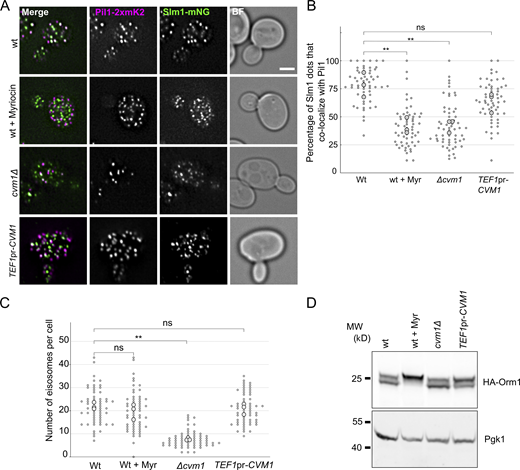 Cvm1 levels affect sphingolipid-sensing pathways. (A) Colocalization of Slm1 with Pil1. Colocalization of Slm1-mNeonGreen with Pil1-2xmKate2 was analyzed in WT, cvm1Δ, and TEF1pr-CVM1 strains. As a control, the WT strain was incubated with 5 μM myriocin for 45 min. Scale bar represents 2μm. BF = Brightfield. (B) Plot showing the quantification of the experiment shown in A. For each image, a manual threshold was applied for each channel, and the percentage of Slm1 structures that colocalized with Pil1 structures was determined for each cell. Each dot represents one cell, and the bigger dots represent the mean for each independent experiment. 20 cells were quantified for each condition and experiment, and the experiment was performed three times. (C) Plot showing the quantification of eisosomes per cell from the experiment shown in A. The number of eisosomes per cell assessed as Pil1-2xmKate2–positive structures was determined. Each dot represents one cell, and the bigger dots represent the mean for each independent experiment. 20 cells were quantified for each condition and experiment, and the experiment was performed three times. (D) Analysis of the phosphorylation-dependent upshift of Orm1. Whole-cell lysates from the indicated strains were used to analyze the upshift of HA-tagged Orm1 by Western blot. As a control, the WT strain was grown for 1 h in YPD + 5 µM myriocin. Pgk1 is used as a loading control. **, P < 0.01. Source data are available for this figure: SourceData F7.