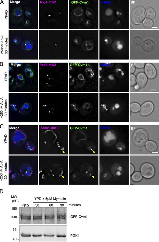 Cvm1-mediated contacts are induced by a decrease in complex sphingolipids, but protein levels of Cvm1 are not altered. Related to Fig. 8. (A) Cvm1 accumulates at the NVJ upon depletion of sphingolipids. Fluorescence microscopy analysis of the localization of GFP-Cvm1 under the control of the endogenous promoter, Nvj1-mKate2 as a NVJ marker, and CMAC staining as a vacuolar marker. Cells were grown in rich media (YPAD) and incubated with 250 nM AbA for 30 min where indicated. Under normal growth conditions, Cvm1 is accumulated in the NVJ in some cells and not in others. After incubation with AbA, the accumulations of Cvm1 at the NVJ become more pronounced and happen in more cells. Scale bar represents 2 μm. BF = Brightfield. (B) Cvm1 accumulations at the PerVale are more frequent upon decreasing sphingolipid levels. Fluorescence microscopy analysis of the localization of GFP-Cvm1 under the control of the endogenous promoter, Pex3-mKate2 as a peroxisomal marker, and CMAC staining as a vacuolar marker. Cells were grown in YPAD and incubated with 5 μM AbA for 60 min where indicated. Scale bar represents 2 μm. (C) Cvm1 accumulations at the vCLAMP are more frequent upon decreasing sphingolipid levels. Fluorescence microscopy analysis of the localization of GFP-Cvm1 under the control of the endogenous promoter, Shm1-mKate2 as a mitochondrial marker, and CMAC staining as a vacuolar marker. Cells were grown in YPD and incubated with 5 μM AbA for 60 min where indicated. The yellow arrowheads indicate accumulations of Cvm1 on the vacuole membrane that co-localize with the mitochondrial network. Scale bar represents 2 μm. (D) Cvm1 protein levels are not affected by myriocin treatment. Whole-cell lysates of a strain containing GFP-Cvm1 under the control of its endogenous promoter were normalized by total protein amount and analyzed by SDS-PAGE and Western blot. The levels of GFP-Cvm1 do not change significantly throughout the treatment with the drug. Pgk1 was used as a loading control. Source data are available for this figure: SourceData FS5.