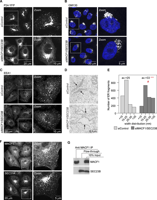 MACF1 functionally interacts with SEC23B at the ER exit level.(A) Confocal images of HeLa cells stably expressing P24-YFP and transfected with the indicated siRNAs for 48 h. Arrows indicate ER membranes. (B and C) Confocal images of cells transfected with the indicated siRNAs for 48 h, fixed, and stained with anti-GM130 antibody (B) or anti-EEA1 antibody (C). (D) EM images of cells treated with the indicated siRNAs for 48 h. Arrows indicate ER membranes. The bloated ER in the MACF1/SEC23B double knockdown is characteristic of an ER transport block. (E) Quantification of the EM images. Histogram representing the distribution of ER membranes width. Average (av.) values are also shown. Statistical significance: ***, P < 0.001 compared with control, Student’s t test; #, P < 0001, χ2 test for the distribution. (F) Confocal images of untreated HeLa cells fixed and costained for MACF1 and SEC31A as a marker for ERES. (G) Co-IP experiment. HeLa cells were lysed and incubated with anti-MACF1 antibody bound to agarose-protein beads at 4°C overnight. The beads were washed and loaded into gels. Western blot was performed using anti-MACF1 and anti-SEC23B antibodies. Source data are available for this figure: SourceData FS1.