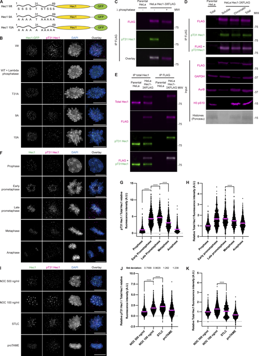 The antibody raised against pT31 binds only to pT31; Hec1 is phosphorylated on T31 in prometaphase RPE1 cells; pT31 is maximally phosphorylated in cells arrested in STLC when analyzed by IF. (A) Cartoon illustration of the Hec1-GFP constructs used in Fig. S3 showing the mutations made and the remaining potential phosphorylation sites. (B) Immunofluorescence images of HeLa doxycycline inducible Hec1 knockout cells in early prometaphase transfected with the indicated Hec1-GFP constructs. 72 h after transfection the cells were fixed and stained for pT31 Hec1 and DAPI. The GFP and pT31 channels were adjusted evenly for brightness and contrast. The DAPI channel was adjusted independently. The scale bars are 10 μm. Representative images of two independent biological experiments are shown. (C) Western blots showing an anti-FLAG immunoprecipitation from HeLa Hec1-3XFLAG or parental HeLa cells. The cells were synchronized by thymidine-NOC and then prepared as a total cell lysate. Hec1-3XFLAG was then immunoprecipitated. Following washes, the samples were mock treated or treated with Lambda phosphatase for 20 min at 30°C. The purified proteins were then separated by SDS-PAGE, transferred to nitrocellulose membrane, and finally blotted as indicated. The panels were adjusted for brightness and contrast for presentation. An experiment representative of two independent biological repeats is shown. (D) Western blots showing an anti-FLAG immunoprecipitation from HeLa Hec1-3XFLAG and parental HeLa cells. The cells were synchronized by thymidine-NOC and then prepared as a total cell lysate or fractionated into soluble and chromatin fractions. Hec1-3XFLAG was then immunoprecipitated and the purified proteins were then separated by SDS-PAGE, transferred to nitrocellulose membrane, and finally blotted as indicated. The panels were adjusted for brightness and contrast for presentation. An experiment representative of two independent biological repeats is shown. (E) Western blots showing either anti-FLAG or total Hec1 immunoprecipitation from HeLa Hec1-3XFLAG or parental HeLa cells. The cells were synchronized by thymidine-NOC and then prepared as a total cell lysate. Hec1 was then immunoprecipitated and the purified proteins were then separated by SDS-PAGE, transferred to nitrocellulose membrane and finally blotted as indicated. The panels were adjusted for brightness and contrast for presentation. An experiment representative of two independent biological repeats is shown. (F) Immunofluorescence images of RPE1 cells in various stages of mitosis taken from an asynchronous population. 48 h after plating the cells were fixed and stained for Hec1, pT31 Hec1, and DAPI. The Hec1 and pT31 Hec1 channels were adjusted evenly for brightness and contrast. The DAPI channel was adjusted independently. The scale bars are 10 μm. Representative images of two independent biological experiments are shown. (G) Quantification of the relative pT31 Hec1/Total Hec1 kinetochore intensities from the conditions in F. The condition with the lowest level of pT31 was set to 1 and the other conditions shown as fold-changes. 25 kinetochores were quantified from each of 20 cells for each of two independent biological repeats. Error bars indicate the mean ± SEM. ****, P < 0.0001. Statistical significance was calculated between the indicated conditions using two-tailed t tests. (H) Quantification of kinetochore total Hec1 levels from the conditions from F and G. The levels of Hec1 shown from the prophase condition were set to 1 and the other conditions shown as fold-changes. 25 kinetochores were quantified from each of 20 cells for each of two independent biological repeats. Error bars indicate the mean ± SEM. ****, P < 0.0001. Statistical significance was calculated between the indicated conditions using two-tailed t tests. (I) Immunofluorescence images of HeLa cells synchronized by thymidine and then NOC, STLC, or proTAME. The cells were then fixed and stained for Hec1, pT31 Hec1, and DAPI. The Hec1 and pT31 Hec1 channels were adjusted evenly for brightness and contrast. The DAPI channel was adjusted independently. The scale bars are 10 μm. Representative images of three independent biological experiments are shown. (J) Quantification of the relative pT31 Hec1/Total Hec1 kinetochore intensities from the conditions in I. The condition with the lowest level of pT31 was set to 1 and the other conditions shown as fold-changes. 25 kinetochores were quantified from each of 20 cells for each of three independent biological repeats. Error bars indicate the mean ± SEM. ****, P < 0.0001. Statistical significance was calculated between the indicated conditions using two-tailed t tests. (K) Quantification of kinetochore total Hec1 levels from the conditions from I and J. The levels of Hec1 shown from the prophase condition were set to 1 and the other conditions shown as fold-changes. 25 kinetochores were quantified from each of 20 cells for each of three independent biological repeats. Error bars indicate the mean ± SEM. ****, P < 0.0001. Statistical significance was calculated between the indicated conditions using two-tailed t tests. Source data are available for this figure: SourceData FS3. Refer to the image caption for details.