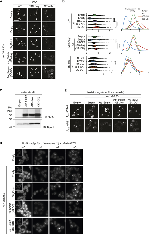Hydroxyl-containing residues in human Seipin are required for correct LD morphology in TAG-only and SE-only cells. Related to Fig. 6. (A) Analysis of LD morphology in cells with indicated genotype by super resolution fluorescence microscopy. Cells were cultured in inositol free media at 30°C to late stationary phase, and LDs were stained with BODIPY. Scale bars correspond to 5 μm. (B) Quantification of LD size in cells shown in A. A minimum of 100 LDs per genotype and two independent biological replicates were quantified. Bars and whiskers indicate mean with interquartile range. (C) Levels of FLAG-tagged WT human Seipin and its derivatives with mutations in S165/166, SS-AA and SS-DD, expressed in sei1∆ldb16∆ cells. Whole cell lysates were separated by SDS-PAGE and analyzed by immunoblot with anti-FLAG antibody. Dpm1 was used as a loding control and detected with an anti-Dpm1 antibody. (D) Analysis of LD biogenesis upon induction of SE synthesis by expression of the SE acyltransferase Are1. Plasmid-borne expression of Are1 was induced by addition of galactose (final concentration 2%) to cells with the indicated genotype grown in raffinose-containing medium. LDs were stained with BODIPY at indicated timepoints (in hours after galactose induction). Scale bars correspond to 5 μm. (E) Analysis of LD morphology in cells with indicated genotype upon plasmid borne overexpression of the NL enzymes Dga1 or Are1 which synthesize TAG or SE, respectively. Micrographs were take after 24 h addition of galactose to induce the expression of the NL synthesizing enzymes. LDs were visualized using the NL dye BODIPY 493/503. Scale bars correspond to 5 μm. Source data are available for this figure: SourceData FS4.