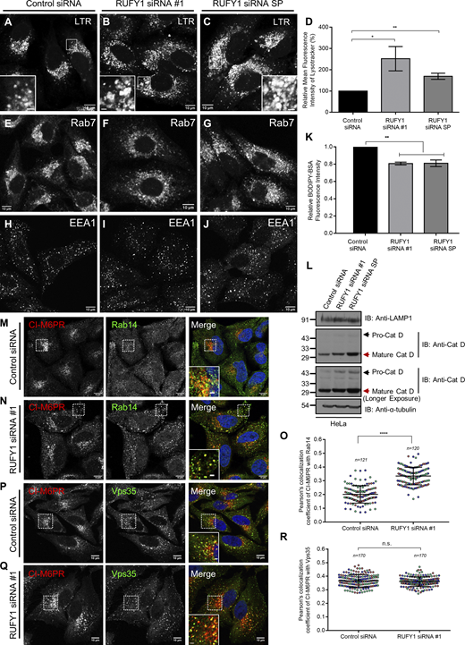 RUFY1 depleted cells show features of lysosome dysfunction and enhanced colocalization of CI-M6PR and Rab14. (A–C) Representative confocal images of HeLa cells treated for 60 h with the indicated siRNAs and incubated for 2 h with Lysotracker Red (LTR) before fixation. Bars: (main) 10 µm; (insets) 2 µm. (D) Measurement of the fold change in LTR intensity in HeLa cells treated with the indicated siRNAs and analyzed by flow cytometry. The values plotted are the mean ± SD from three independent experiments (**P < 0.01; *P < 0.05; unpaired two-tailed t test). (E–J) Confocal micrographs of HeLa cells treated with the indicated siRNAs followed by immunostaining with anti-Rab7 or anti-EEA1 antibodies. Bars: 10 µm. (K) HeLa cells were treated with the indicated siRNAs and subjected to BODIPY-BSA uptake for 7 h. The BODIPY-BSA fluorescence was analyzed by flow cytometry. The values plotted are the mean ± SD from three independent experiments (**P < 0.01; unpaired two-tailed t test). (L) Western blot analysis of pro-cathepsin D (Cat D), mature Cat D, and LAMP1 levels in either control or RUFY1 siRNA-treated HeLa cells. α-tubulin was used as a loading control. (M, N, P, and Q) Representative confocal images of HeLa cells treated with control or RUFY1 siRNA, followed by immunostaining with anti-CI-M6PR and anti-Rab14 antibodies (M and N) or anti-CI-M6PR and anti-Vps35 antibodies (P and Q). Bars: (main) 10 µm; (insets) 2 µm. (O and R) The Pearson’s colocalization coefficient of CI-M6PR with Rab14 (O) or CI-M6PR and Vps35 (R) was measured in HeLa cells treated with either control or RUFY1 siRNA. The values plotted are the mean ± SD from three independent experiments. Experiments are color-coded, and each dot represents the individual data points from each experiment. The total number of cells analyzed is indicated on the top of each data set (****P < 0.0001; n.s., not significant; unpaired two-tailed t test). Source data are available for this figure: SourceData FS4. Refer to the image caption for details.