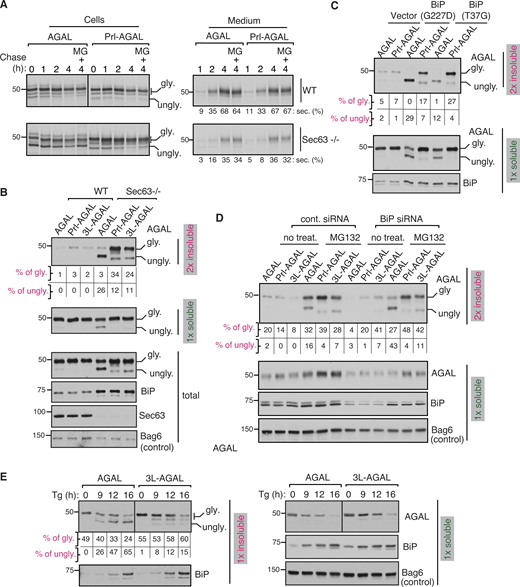 Marginally hydrophobic SSs prevent protein misfolding and aggregation in the ER under limited BiP availability. (A) WT or Sec63−/− cells expressing AGAL or Prl-AGAL were radiolabeled for 30 min and chased in the presence or absence of 20 μM MG132 for the indicated time points. Both cells and medium were collected at each time point and analyzed by autoradiography after IP with an anti-HA antibody for AGAL. Secreted AGAL is given as the percentage of total signals from both secreted and intracellular bands. Images were taken from the same exposure and processed in parallel. (B) Cells expressing the indicated constructs were lysed in NP40 buffer, and the aliquots of total lysates and detergent-soluble fractions were analyzed by immunoblotting. The detergent-insoluble fractions were lysed in an SDS sample buffer and analyzed by immunoblotting. BiP, Sec63, and Bag6 were blotted from soluble fractions. The percent translocated/glycosylated protein values were calculated by insoluble glycosylated signal divided by the sum of glycosylated and unglycosylated signals from both soluble and insoluble fractions. The percent of non-translocated/unglycosylated form was calculated by insoluble unglycosylated signal divided by the sum of glycosylated and unglycosylated signals from both soluble and insoluble fractions. (C) HEK293 cells were co-transfected with the indicated AGAL constructs and vector, BiP (G227D) or BiP (T37G). Cells were treated with 10 μM MG132 for 6 h to detect non-translocated AGAL before harvesting and analyzing as in B. (D) Control or BiP siRNA treated HEK293 cells were transfected with the indicated AGAL construct and harvested after treating the cells with 10 μM MG132 for 6 h. Cells were lysed and analyzed as in B. (E) HeLa cells expressing AGAL constructs were treated with 5 μg/ml thapsigargin (Tg) along with 10 μM MG132 for the indicated time points and harvested in RIPA buffer. The soluble fractions were collected after centrifugation, and the insoluble fractions were solubilized by boiling in 1% SDS buffer. Both soluble and insoluble fractions were analyzed by immunoblotting for the indicated antigens. Source data are available for this figure: SourceData F6. Refer to the image caption for details.