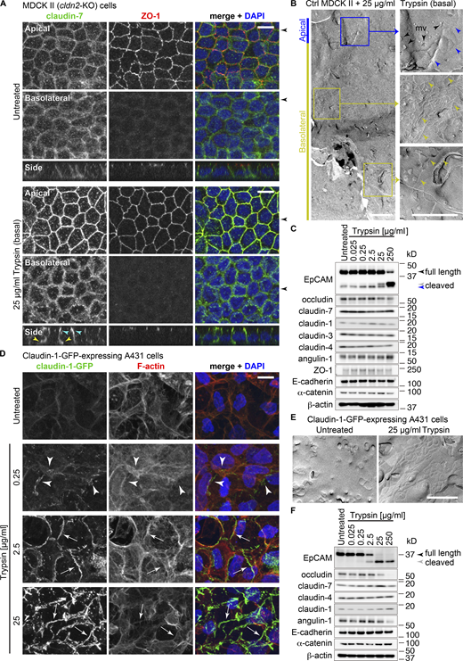Trypsin induces the TJ strand formation and cleavage of EpCAM. (A) Trypsin-induced claudin-7 puncta formation on the basolateral membranes. Untreated Ctrl cells (upper panels) and Ctrl cells treated with 25 µg/ml trypsin (lower panels) were stained with rabbit anti–claudin-7 pAb (green) and rat anti–ZO-1 mAb (red) together with DAPI (blue). Cyan and yellow arrowheads in the side-view panels indicate TJs and basolateral punctate signals, respectively. Black arrowheads on the sides of top views indicate the positions of the side view. Scale bars, 10 µm. (B) FFEM of trypsin-treated Ctrl cells. Blue and yellow arrowheads indicate the TJ strands at the TJs in the apicolateral and basolateral regions, respectively. mv, microvilli. Scale bars, 1 µm. (C) Immunoblotting of Ctrl cells treated with various concentrations of trypsin using rabbit anti-EpCAM mAb and other antibodies. (D) Trypsin-induced claudin-1–based structure in the claudin-1-GFP–expressing A431 cells. Cells were stained for F-actin with phalloidin (red) and DAPI (blue) and the fluorescence of GFP (green) was observed. Arrowheads and arrows indicate faint and intense claudin-1 signals, respectively. Scale bar, 10 µm. (E) FFEM of the trypsin-treated A431 cells. Scale bar, 1 µm. (F) Immunoblotting of A431 cells treated with various concentrations of trypsin using mouse anti-EpCAM mAb and other antibodies. Source data are available for this figure: SourceData F1.