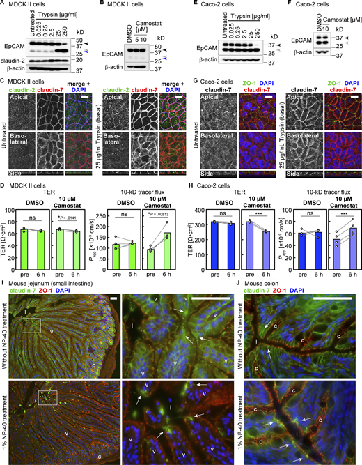 EpCAM/claudin-7–dependent barrier maintenance in other epithelial models. (A and E) Immunoblotting of parental MDCK II cells (A) and Caco-2 cells (E) treated with various concentrations of trypsin using rabbit anti-EpCAM mAb and other antibodies. Black, gray, and blue arrowheads indicate full-length, cleaved, and 29-kD bands, respectively. (B and F) Effects of camostat treatment for 16 h on parental MDCK II cells (B) and Caco-2 cells (F). (C and G) Effects of trypsin on the localization of claudin-7 (red) in parental MDCK II cells (C) and Caco-2 cells (G). Cells were co-stained with claudin-2 (green) and ZO-1 (blue; C) or ZO-1 (green) and DAPI (blue; G). Scale bars, 10 µm. (D and H) Effects of camostat on TER and permeability of 10-kD FITC-dextran in parental MDCK II cells (D) and Caco-2 cells (H). ns, P > 0.05; *, P < 0.05; ***, P < 0.001 (two-tailed paired t test). (I and J) Immunostaining of frozen sections of the small intestine (I) and colon (J). Tissue sections were either untreated (upper panels) or treated with NP-40 before fixation (lower panels) and stained for claudin-7 (green), ZO-1 (red), and DAPI (blue). White arrows indicate the tips of the villi. The tip region of villi in the left panels (white rectangle in I) was enlarged and shown in the right panels. l, lumen; v, villus; c, crypt. Scale bars, 50 µm. Source data are available for this figure: SourceData F9. Refer to the image caption for details.