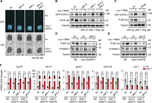 Increased expression of ATFS-1 in response to mitochondrial stress is independent of the GCN-2/PEK-1 signaling. (A) RNAi of gcn-2 and/or pek-1 did not affect UPRmt activation. hsp-6p::gfp worms were fed with control, gcn-2, and/or pek-1 RNAi, in combination with cco-1 RNAi. Scale bar, 0.3 mm. (B) Western blots of atfs-1p::atfs-1::flag::gfp worms fed with control, gcn-2, and/or pek-1 RNAi, with or without cco-1 RNAi. (C) Western blots of atfs-1p::atfs-1::flag::gfp worms fed with control, eif-2α and/or cco-1 RNAi. (D) Western blots of WT (N2) or gcn-2(ok871) worms fed with control, pek-1, and/or cco-1 RNAi. (E) Western blots of wild-type or pek-1(ok275) worms fed with control, gcn-2, and/or cco-1 RNAi. (F) qRT-PCR analysis of transcripts (n = 4 biologically independent samples) in wild-type, gcn-2(ok871) or pek-1(ok275) worms fed with control, pek-1, gcn-2 and/or cco-1 RNAi. Error bars denote SEM. Statistical analysis was performed by ANOVA followed by Tukey post-hoc test (***P < 0.001). Source data are available for this figure: SourceData F5.