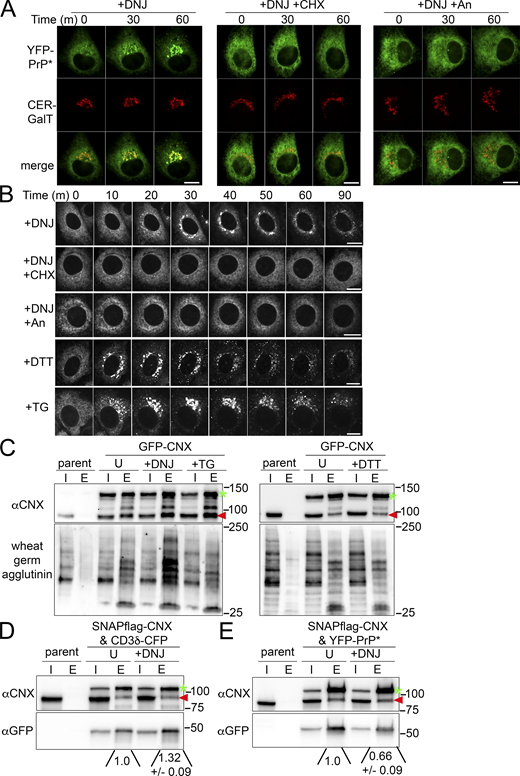 Deoxynojirimycin-treatment enhances the flux of YFP-PrP* through the RESET pathway, the binding of glycoproteins to CNX, and the release of YFP-PrP* from CNX. (A) Time-lapse imaging of representative YFP-PrP* and Cerulean (CER)-GalT NRK cells after treatment with 2.5 mM deoxynojirimycin alone (DNJ) or with 50 μg/ml cycloheximide (DNJ+CHX), or with 0.5 μM anisomycin (DNJ+An). CER-GalT is a Golgi marker. (B) Time-lapse imaging of representative YFP-PrP* NRK cells that were treated with 2.5 mM DNJ, DNJ+CHX, DNJ, DNJ+An, 0.5 mM dithiothreitol (DTT), or 1 μM thapsigargin (TG). (C) Representative western blots depicting GFP-column purifications from N2a cell lysates of untransfected (parent) cells or GFP-CNX-transfected cells 48 h after transient transfection. Blots were probed with anti-CNX (αCNX) antibody to detect GFP-CNX (green arrow) or endogenous CNX (red arrowhead) that co-eluted with GFP-CNX or probed with wheat germ agglutinin to detect general glycosylated proteins that co-eluted with GFP-CNX. Input “I” and eluate “E.” Cells were untreated (“U”) or treated with DNJ, TG, and DTT for 30 min, as indicated, prior to lysis. The experiment was performed in triplicate with similar results. (D and E) Representative western blots depicting flag-column purifications from N2a cell lysates of untransfected (parent) cells or transfected cells ∼72 h after transient transfection with (D) SNAPflag-CNX and CD3δ-CFP or (E) SNAPflag-CNX and YFP-PrP*. Blots were probed with anti-CNX (αCNX) antibody to detect SNAPflag-CNX (green arrow) or endogenous CNX (red arrowhead) that coeluted with SNAPflag-CNX and with anti-GFP antibody to probe for (D) CD3δ-CFP or (E) YFP-PrP* that co-eluted with SNAPflag-CNX. Input “I” and eluate “E.” Cells were untreated “U” or treated with DNJ for 15 m, as indicated, prior to lysis. Experiments were performed in triplicate. Integrated densitometry measurements were made of the αGFP bands. Quantification of the relative pixel density of the αGFP bands that co-purified with SNAPflag-CNX was made by first creating a rectangular bounding box or region of interest (ROI) that enclosed the larger eluate band. For D, the larger αGFP band was in the +DNJ eluate lane. For E, the larger αGFP band was in the untreated “U” eluate lane. Next, for D and E respectively, the ROI that enclosed the larger αGFP eluate band was dragged to enclose and measure the integrated density of αGFP eluate band untreated “U” and "+DNJ" co-eluates, and integrated densities within the bounding box were measured. Finally, the eluate αGFP bands in the "U" and "+DNJ" lanes were background subtracted and normalized against the “U” eluate band to obtain the relative pixel densities. These results are representative of three independent experiments (n = 3, biological replicates) ± SD. Source data are available for this figure: SourceData F5. Refer to the image caption for details.