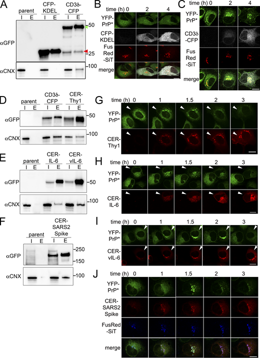 New expression of CNX-binding N-linked glycoproteins triggers RESET of PrP*. (A) Western blots depicting GFP column purifications from parental, untransfected N2a cells (parent), or N2a cells 12 h after transient transfection with ER-targeted CFP-KDEL or CD3δ-CFP. Blots were probed with anti-GFP antibodies to detect CFP-KDEL or CD3δ-CFP and with anti-CNX antibody to detect endogenous CNX. Blue asterisk and red arrowhead placed next to the GFP-blot align with full-length CD3δ-CFP and CFP-KDEL, respectively. Input “I,” eluate “E.” (B and C) Time-lapse imaging of representative NRK cells stably expressing YFP-PrP* and the Golgi marker, FusionRed-SiT (FusRed-SiT), and transiently transfected with (B) ER-targeted CFP (CFP-KDEL) or (C) CD3δ-CFP. Image collection was started 2 h after transient transfection. Scale bar, 10 μm. (D–F) Western blots depicting GFP column purifications from parental, untransfected N2a cells (parent) or N2a cells 12 h after transiently transfecting cells with (D) CD3δ-CFP or Cerulean-Thy1, (E) Cerulean-IL-6 or Cerulean-vIL-6, and (F) Cerulean-SARS CoV-2 Spike Glycoprotein “Cer-SARS2 Spike,” and probed with anti-GFP antibody or anti-CNX antibody. Input “I” and eluate “E.” (G–J) Time-lapse imaging of YFP-PrP* NRK cells that were transiently transfected with Cerulean-tagged N-linked glycoproteins that were reported to be upregulated during inflammatory conditions, including (G) Thy1, (H) IL-6, and during a viral infection (I) vIL-6 and (J) SARS2 Spike. For G–I, the fields of view include one cell that was transfected with the Cerulean-tagged N-linked glycoprotein and one cell that remained untransfected. The arrowheads point to cells which were newly expressing the transfected N-linked glycoproteins. For J, cells stably expressed Golgi marker, FusRed-SiT. For G–J, image collection was started 2 h after addition of transfection reagent and plasmids. Scale bar is 10 um. Source data are available for this figure: SourceData F7. Refer to the image caption for details.