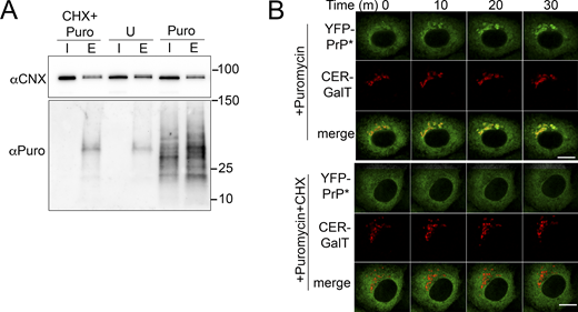 Puromycin treatment of cells produces puromycinylated CNX-associated products and induces RESET of YFP-PrP* by a mechanism that is dependent on new protein synthesis. (A) Western blots depicting column purifications of endogenous CNX from lysates of NRK cells treated with 50 μg/ml cycloheximide and 2.50 µg/ml of puromycin (“CHX+Puro”), untreated (“U”), or treated with puromycin with 2.50 µg/ml of puromycin alone (“Puro”). Blots were probed with anti-CNX (αCNX) antibody to detect endogenous CNX and anti-puromycin antibody to detect puromycinylated proteins products that co-eluted with CNX. Input “I” and eluate “E.” (B) Time-lapse imaging of representative YFP-PrP* and Cerulean (CER)-GalT NRK cells after treatment with 2.50 µg/ml of puromycin alone (“+Puromycin”) or together with 50 μg/ml cycloheximide (“+Puromycin+CHX”), CER-GalT is a Golgi marker. Source data are available for this figure: SourceData F8.