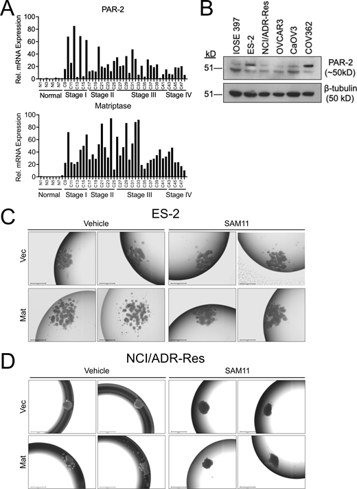 PAR-2 and matriptase are both overexpressed in human OvCa tumors compared to normal ovary tissue. (A) Human TissueScan Ovarian Cancer cDNA Array of 40 ovarian tumor specimens across stages I–IV and 8 normal ovary tissue specimens were assessed for PAR-2 (F2RL1) and matriptase (ST14) mRNA expression by qPCR. Data is normalized to a housekeeping control and represented relative to normal tissue. (B) PAR-2 is expressed in OvCa cell lines. Whole-cell lysates were collected from IOSE397 cells and 5 OvCa cell lines, analyzed by SDS-PAGE, and immunoblotted with mouse anti-human PAR-2 (SAM11) or rabbit anti-human β-tubulin antibodies. (C and D) Matriptase-mediated loose spheroid morphology is attenuated by PAR-2 blocking antibody SAM11. ES-2 and NCI/ADR-Res Vec and Mat hanging-drop spheroids were formed for 4 d in the presence of vehicle control (DMSO) or PAR-2 blocking antibody SAM11. Representative images of DMSO and SAM11 treated Vec and Mat spheroids are shown at 4× magnification using EVOS; scale bars represent 650 μm. Source data are available for this figure: SourceData FS5.