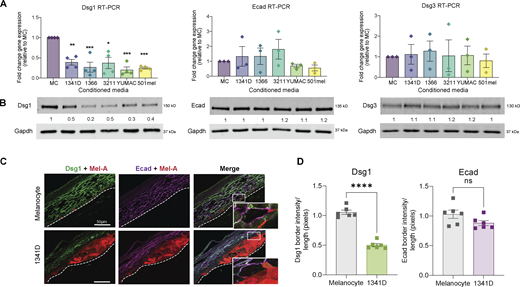 Melanoma cells downregulate keratinocyte Dsg1 through paracrine signaling. Primary human keratinocytes were treated for 24 h with conditioned media from melanocytes (MC) or the melanoma cell lines WM1341D (labeled as 1341D in figures), WM1366 (labeled as 1366 in figures), WM3211 (labeled as 3211 in figures), YUMAC, and 501mel, and RNA or protein was collected. (A and B) RT-PCR (A) and Western blots (B) were performed for Dsg1, Ecad, and Dsg3. Significantly lower mRNA and protein expression of Dsg1, but not Ecad or Dsg3, was observed. n = 3. Mean ± SEM depicted. *P < 0.05; **P < 0.01; ***P < 0.001. One-way ANOVA. (C) Melanocytes or WM1341D melanoma cells were seeded with normal primary keratinocytes and grown as 3D organotypic raft cocultures for up to 10 d. Paraffin sections were costained for Dsg1 or Ecad and Mel-A. The dashed line indicates the basement membrane. (D) Pixel intensities were determined and the ratio of proximal to distant intensities plotted. A significant decrease in Dsg1, but not Ecad, intensity proximal to the WM1341D lesions was observed. Mean ± SEM depicted. n = 6. *P < 0.05, Student’s t test. Source data are available for this figure: SourceData F2.