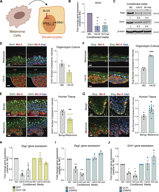 Loss of Grhl1 is associated with melanoma-mediated Dsg1 loss. (A) Model depicting the proposed signaling pathway leading to Dsg1 loss in keratinocytes. (B and C) Primary human keratinocytes were treated for 24 h with conditioned media from melanocytes (MC) or the melanoma cell lines WM1341D and 501mel and RNA or protein was collected. RT-PCR and Western blots were performed for Grhl1. Significantly lower mRNA and protein expression of Grhl1 was observed in the keratinocytes treated with melanoma-conditioned media when compared with melanocyte control–conditioned media. RNA levels and quantification for blots represent average fold change. Mean ± SEM depicted. n = 3. *P < 0.05, **P < 0.01, ***P < 0.001. One-way ANOVA. (D) Melanocytes or WM1341D melanoma cells were seeded with normal primary keratinocytes and grown as 3D organotypic raft cocultures for 6 d. Paraffin sections were costained for Grhl1 and Mel-A. Pixel intensities were determined and the ratio of proximal to distant intensities plotted. A significant decrease in Grhl1 intensity proximal to the WM1341D lesions was observed. Mean ± SEM *P < 0.05. Student’s t test. (E) Paraffin-embedded sections of benign nevi and melanomas were costained for Grhl1 and Mel-A and nuclear and cytoplasmic pixel intensities were measured in cells proximal to Mel-A stained cells and plotted as nuclear/cytoplasmic ratios. A significant decrease in keratinocyte Grhl1 intensity was observed in keratinocytes adjacent to melanoma compared with those in benign nevi. Mean ± SEM depicted. n > 3. **P < 0.01. Student’s t test. (F) Melanocytes or WM1341D melanoma cells were seeded with primary keratinocytes and grown as 3D organotypic raft cocultures for 6–10 d. Paraffin sections were costained for Slug and Mel-A. Pixel intensities were determined, and the ratio of proximal to distant intensities was plotted. A significant increase in Slug intensity proximal to the WM1341D lesions was observed. n = 3 ±SEM; ***P < 0.001. Student’s t test. (G) Paraffin-embedded sections of benign nevi and melanomas were costained for Slug and Mel-A. Nuclear and cytoplasmic pixel intensities were measured in cells proximal to Mel-A stained cells and the nuclear/cytoplasmic ratios were plotted. A significant increase in keratinocyte Slug intensity was observed in keratinocytes adjacent to melanoma compared with those in benign nevi. Mean ± SEM depicted. n > 3. *P < 0.05. Student’s t test. (H) Primary human keratinocytes exogenously expressing GFP or Grhl1 were treated for 24 h with conditioned media from melanocytes (MC) or the melanoma cell lines WM1341D, and 501mel and RNA was collected. RT-PCR was performed for Dsg1. Introduction of Grhl1 into the keratinocytes rescued Dsg1 loss caused by melanoma conditioned media. n = 3. Mean ± SEM depicted. *P < 0.05; **P < 0.01; ***P < 0.001. One-way ANOVA. (I and J) Similarly, primary human keratinocytes exogenously expressing siCTL or siSNAI2 were treated for 24 h with conditioned media from melanocytes (MC) or the melanoma cell lines WM1341D, and 501mel and RNA was collected. RT-PCR was performed for Dsg1 and Grhl1. siSNAI2 transfected keratinocytes rescue Dsg1 and Grhl1 loss caused by melanoma-conditioned media. n = 3. Mean ± SEM depicted. *P < 0.05; **P < 0.01; ***P < 0.001. One-way ANOVA. Source data are available for this figure: SourceData F3.