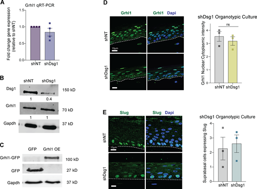 Grhl1 is regulated upstream of Dsg1. (A and B) Retroviral transduction of shNT (non-targeting control) or shDsg1 knockdown vectors was performed in primary human keratinocytes and RNA or protein was collected for RT-PCR and Western blot validation of knockdown. No significant difference in Grhl1 mRNA expression or protein level was observed in response to Dsg1 knockdown. (C) Retroviral transduction of GFP or GRHL1 (Grhl1 OE) was performed in primary human keratinocytes and protein was collected for Western blot validation of expression (see Fig. 3 H). (D) 3D organotypic raft cultures comprises shNT or shDsg1 expressing keratinocytes were grown for 6 d and stained for Grhl1. Nuclear to cytoplasmic staining intensity of Grhl1 was not statistically different between the two cultures. Mean ± SEM depicted. n = 3, Student’s t test. (E) Similarly, 3D organotypic raft cultures composed of shNT or shDsg1 expressing keratinocytes were grown for 6 d and stained for Slug and the number of suprabasal Slug expressing cells was counted. The number of suprabasal Slug expressing cells was not different between the two cultures. n = 3. Student’s t test. Source data are available for this figure: SourceData FS2.