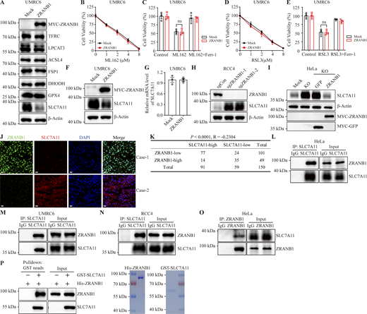 ZRANB1 binds and downregulates the SLC7A11 protein. (A) Western blot analysis of TFRC, LPCAT3, ACSL4, FSP1, DHODH, GPX4, and SLC7A11 expression in ZRANB1-overexpressing UMRC6 cells. (B and D) Cell viability in the indicated UMRC6 stable cell lines after treatment with different concentrations of ML162 (B) or RSL3 (D). (C) Cell viability of the indicated UMRC6 cells treated with 2 μM ML162 with or without 2 μM Ferr-1 for 2 h. (E) Cell viability of the indicated UMRC6 cells, measured after culturing in 2 μM RSL3 with or without 2 μM Ferr-1 for 2 h. (F) SLC7A11 expression levels in the indicated UMRC6 cells were measured by western blot. (G) SLC7A11 expression levels in the indicated UMRC6 cells were measured by quantitative RT-PCR. (H) Western blot analysis of ZRANB1 expression in ZRANB1-KO RCC4 cells. (I) Levels of SLC7A11 protein in HeLa-ZRANB1-KO cells re-overexpressing ZRANB1 were measured by western blot. (J) IF staining of SLC7A11 (red) and ZRANB1 (green) in representative human KIRC samples. The right images are the overlay of SLC7A11, ZRANB1, and nuclear DAPI (blue) staining. Scale bars, 20 μm. (K) Correlation between SLC7A11 and ZRANB1 protein levels in KIRC patients. R is the Spearman correlation coefficient. The P value was obtained from a chi-square test. (L–N) Coimmunoprecipitation of endogenous SLC7A11 with ZRANB1. SLC7A11 was immunoprecipitated from HeLa (L), UMRC6 (M), or RCC4 (N) cells, followed by immunoblotting with antibodies against ZRANB1. (O) Western blot analysis of endogenous SLC7A11 after IP of endogenous ZRANB1 from HeLa cells. (P) Left panel: Purified His-ZRANB1 was incubated with purified GST-SLC7A11 and subjected to GST pull-down followed by immunoblotting with the indicated antibodies. Right panel: Purified recombinant His-ZRANB1 and GST-SLC7A11 proteins were analyzed by SDS-PAGE and Coomassie blue staining. (B–E and G) Error bars are means ± SEM, n = 3 biological replicates. (G) P values measured using two-tailed unpaired Student’s t test analysis. (B–E) P values determined by two-way ANOVA. Source data are available for this figure: SourceData F4.