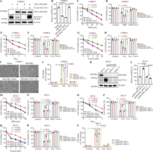 ZRANB1 promotes ferroptosis through SLC7A11. (A) Western blot analysis of ZRANB1 and SLC7A11 in the indicated UMRC6 cell lines. (B) Bar graphs showing intracellular GSH levels in the indicated UMRC6 cells. (C and G) Cell viability in UMRC6 stable cell lines after treatment with different concentrations of TBH (C) or Erastin (G). (D, F, and H) Bar graphs showing the viability of the indicated UMRC6 cells treated with 100 μM TBH (D), cultured under cystine starvation conditions for 2 d (F), or treated with 20 μM Erastin (H) with or without 2 μM Ferr-1. (E) Viability of UMRC6 cells cultured under cystine starvation conditions for the indicated durations. (I) Representative phase-contrast images of the indicated UMRC6 cells treated with 20 μM Erastin for 30 h. Scale bars, 50 μm. (J) Bar graphs showing cell death in the indicated UMRC6 cell lines following Erastin treatment. (K) Western blot analysis of SLC7A11 in ZRANB1-KO RCC4 cell lines with or without knockdown of SLC7A11. (L) Bar graphs showing intracellular GSH levels in the indicated RCC4 cells. (M and Q) Cell viability in RCC4 stable cell lines after treatment with different concentrations of TBH (M) or Erastin (Q). (N and P) Bar graphs showing the viability of the indicated RCC4 cells treated with 100 μM TBH (N) or cultured under cystine starvation conditions for 2 d (P) with or without 2 μM Ferr-1. (O) Cell viability of RCC4 cells measured upon culture under cystine starvation conditions for the indicated durations. (R and S) Bar graphs showing the viability (R) or cell death (S) of the indicated RCC4 cells treated with 10 μM Erastin with or without 2 μM Ferr-1. (B–H, J, and L–S) Error bars are means ± SEM, n = 3 biological replicates. (B and L) P values measured using one-way ANOVA. (C–H, J, and M–S) P values determined by two-way ANOVA. Source data are available for this figure: SourceData F6.