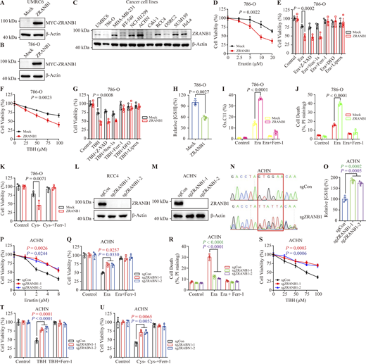 ZRANB1 promotes ferroptosis in vitro. (A and B) Western blot for ZRANB1 in UMRC6 (A) and 786-O (B) cells transfected with the ZRANB1 expression construct. (C) Immunoblotting analyses of ZRANB1 protein levels in different cancer cell lines. (D and F) Cell viability in the indicated 786-O stable cell lines after treatment with different concentrations of Erastin (D) or TBH (F). (E and G) Bar graphs showing cell viability in 786-O cell lines treated with 10 μM Erastin (E) or 100 μM TBH (G) combined with or without 5 μM Z-VAD, 2 μM Nec-1s, 2 μM Ferr-1, 100 μM DFO, or 10 μM Liprox. (H) Bar graph showing intracellular GSH levels in the indicated 786-O cells. (I) Lipid peroxidation was assessed by flow cytometry after C11-BODIPY staining in the indicated 786-O cells. (J) Cell death measured in the indicated 786-O cells after treatment with 10 μM Erastin together with or without 2 μM Ferr-1 for 24 h. (K) Cell viability of the indicated 786-O cells, measured after culturing under cystine starvation conditions with or without 2 μM Ferr-1 for 48 h. (L and M) Western blot analysis of ZRANB1 expression in ZRANB1-KO RCC4 (L) and ACHN (M) cells. (N) DNA sequencing to validate the gene editing of ZRANB1. (O) Bar graph showing intracellular GSH levels in the indicated ACHN cells. (P and S) Cell viability in the indicated ACHN stable cell lines after treatment with different concentrations of Erastin (P) or TBH (S). (Q) Cell viability measured in the indicated ACHN cells treated with 2 μM Erastin and 1 μM Ferr-1 for 24 h. (R) Cell death measured in the indicated ACHN cells treated with 2 μM Erastin and 1 μM Ferr-1 for 24 h. (T and U) Cell viability of the indicated ACHN cells, measured after treatment with 100 μM TBH and 2 μM Ferr-1 for 24 h (T) or measured after culturing in cystine starvation conditions with or without 2 μM Ferr-1 for 48 h (U). (H) P values measured using two-tailed unpaired Student’s t test analysis. (D–K and O–U) Error bars are the means ± SEM, n = 3 biological replicates. (O) P values measured using one-way ANOVA. (D–G, I–K, and P–U) P values determined by two-way ANOVA. Source data are available for this figure: SourceData FS2. Refer to the image caption for details.