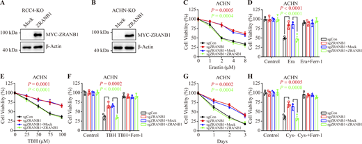 Restoration of ZRANB1 resensitized tumor cells to ferroptosis. (A and B) Western blot analysis of ZRANB1 re-expression in ZRANB1-KO RCC4 (A) and ACHN (B) cells. (C and E) Cell viability in the indicated ACHN stable cell lines after treatment with different concentrations of Erastin (C) or TBH (E). (D and F) Cell viability measured in the indicated ACHN cells treated with 2 μM Erastin (D) or 100 μM TBH (F) and 2 μM Ferr-1 for 24 h. (G) Cell viability of the indicated ACHN cells measured upon culture under cystine starvation conditions for the indicated durations. (H) Cell viability of the indicated ACHN cells, measured after culturing under cystine starvation conditions with or without 2 μM Ferr-1 for 48 h. (C–H) Error bars are the means ± SEM, n = 3 biological replicates. (C–H) P values determined by two-way ANOVA. Source data are available for this figure: SourceData FS3. Refer to the image caption for details.