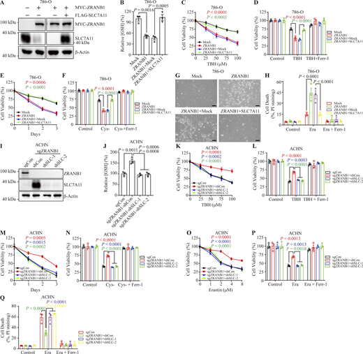 ZRANB1 regulates SLC7A11, influencing sensitivity to ferroptosis. (A) Western blot analysis of ZRANB1 and SLC7A11 in the indicated 786-O cell lines. (B) Bar graphs showing intracellular GSH levels in the indicated 786-O cells. (C and E) Cell viability in 786-O stable cell lines after treatment with different concentrations of TBH (C) or culture under cystine starvation conditions for the indicated durations (E). (D and F) Bar graphs showing cell death in the indicated 786-O cells induced by 100 μM TBH with or without 2 μM Ferr-1 (D) or cultured under cystine starvation conditions for 2 d with or without 2 μM Ferr-1 (F). (G) Representative phase-contrast images of the indicated 786-O cells treated with 10 μM Erastin for 30 h. Scale bars, 50 μm. (H) Bar graphs showing cell death in the indicated 786-O cell lines following Erastin treatment. (I) Western blot analysis of SLC7A11 in ZRANB1-KO ACHN cell lines with or without knockdown of SLC7A11. (J) Histograms showing intracellular GSH levels in the indicated ACHN cells. (K and O) Cell viability in ACHN stable cell lines after treatment with different concentrations of TBH (K) or Erastin (O). (L and N) Histograms showing the viability of the indicated ACHN cells treated with 100 μM TBH with or without 2 μM Ferr-1 (L) or cultured under cystine starvation conditions for 2 d with or without 2 μM Ferr-1 (N). (M) Cell viability of ACHN cells measured upon culture under cystine starvation conditions for the indicated durations. (P) Histograms showing the viability of the indicated ACHN cells treated with 10 μM Erastin with or without 2 μM Ferr-1. (Q) Histograms showing cell death in the indicated ACHN cell lines after 10 μM Erastin treatment with or without 10 μM Ferr-1. (B and J) P values measured using one-way ANOVA. (B–F, H, and J–Q) Error bars are the means ± SEM, n = 3 biological replicates. (C–F, H, and K–Q) P values determined by two-way ANOVA. Source data are available for this figure: SourceData FS6.