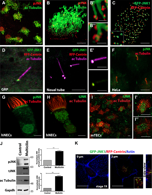JNK is closely associated with the BBs of both motile and primary cilia. (A) Immunostaining of stage 32 Xenopus embryos with anti-phospho-JNK (pJNK) and anti-acetylated-α-tubulin (ac Tubulin) to visualize cilia. pJNK is localized at the base of motile cilia. Scale bars, 10 μm. (B–B’’) Higher magnification images of pJNK at the base of cilia. Scale bars, 1 μm. (C) GFP-JNK and RFP-Centrin mRNA were injected into the ventral marginal region of two blastomeres at the four-cell stage, and the embryos were observed at stage 32. JNK forms a ring around basal bodies Scale bars, 5 μm. (D) GRP ciliated cells of a stage 17 embryo expressing RFP-Centrin and GFP-JNK1, immunostained for acetylated tubulin. GFP-JNK1 is associated with the basal bodies in GRP ciliated cells. Scale bar, 5 μm. (E) Neural tube cross section of a stage 22 embryo coexpressing GFP-JNK1 and centrin2 RFP and immunostained for acetylated tubulin. Scale bar, 5 μm. (E’) The right panels represent magnified insets marked by white squares. Scale bar, 2 μm. (F) Confocal immunofluorescence images of serum-starved HeLa cells showing that pJNK is localized at the base of primary cilia. Scale bar, 2 μm. (G) Immunofluorescent images of human nasal MCCs showing anti-acetylated tubulin and anti-pJNK showing that pJNK is localized at the base of motile cilia. Scale bar, 2 μm. (H) Immunofluorescent images of human nasal MCCs showing anti-acetylated tubulin and anti-tJNK. Scale bar, 2 μm. (I–I’’) Representative confocal images of endogenous localization of acetylated tubulin and JNK (tJNK) in mouse tracheal MCCs showing apical enrichment of JNK. Scale bar, 5 μm. (J) Western blot analysis showing elevated pJNK and JNK protein levels in skin lysates from embryos overexpressing multicilin and controls. Quantification shows the normalized ratio of pJNK/GAPDH intensity. Data represent mean ± SEM from three independent experiments. ***, P < 0.001, unpaired two-tailed t test. (K) Optical section of an intercalating multiciliated cell expressing GFP-JNK1 and RFP-Centrin and stained for actin. GFP-JNK1 is associated with the basal bodies during the early stages of ciliogenesis. Scale bar, 20 μm. Source data are available for this figure: SourceData F1. Refer to the image caption for details.