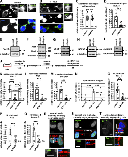Depletion of Top2α does not impair actin-patch formation in cytokinesis with chromatin bridges. (A and B) Actin patches (empty arrowheads) in cytokinesis with chromatin bridges in BE cells, in the absence (control) or presence of Top2α siRNA. The bases of the canals are shown at higher magnification. Broken chromatin bridges are indicated by dotted arrows. (C) Relative actin-patch intensity values. (D) Mean intensity of INCENP at the midbody ring in cells with chromatin bridges. Values in control were set to 1. Mean ± SD from n cells. (E–I) Western blot analysis of total Rad50, ATM, Nbs1, Chk2, INCENP, Aurora B, actin, and tubulin. (J) Experimental procedure for Top2-inhibition by ICRF-193 or etoposide in cells enriched in cytokinesis after release from a nocodazole block. (K and L) Mean intensity of Mre11 or ATM at the bridge DNA next to the midbody in cells with chromatin bridges after nocodazole release, in the absence (control) or presence of 10 μM ICRF-193 or 10 μM etoposide. (M) Mean intensity of INCENP to the midbody ring in cells with chromatin bridges after nocodazole release. Mean ± SD from n cells. Values in control were set to 1. (N) Frequency of broken chromatin bridges in cytokinesis after nocodazole release. Mean ± SD from three independent experiments (n > 120). (O–Q) Mean intensity of Mre11 or ATM at the bridge DNA next to the midbody and of Aurora B at the midbody ring in HU-induced BE cells with chromatin bridges. Mean ± SD from n cells. Values in control were set to 1. ***, P < 0.001 (ANOVA and Student’s t test). Numbers below/next to each bar indicate n. Values in control were set to 1. (R–T) Localization of Top2α and Rad17 at the midbody in normally segregating cells. Tubulin values indicate midbody thickness. Midbodies (boxed areas) were reexported and are shown at higher magnification. Scale bars, 5 μm. Source data are available for this figure: SourceData FS3.
