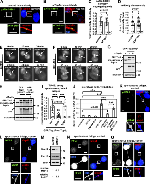 Top2 inhibition does not accelerate midbody disassembly in normally segregating cells. (A–C) Localization and mean intensity of phosphorylated ATM-S1981 (pATM) at the midbody in normally segregating BE cells, in the absence (control) or presence of Top2α siRNA. Tubulin values indicate midbody thickness. Mean ± SD from n cells. Values in control were set to 1. (D–F) Time-lapse microscopy analysis of HeLa cells expressing tubulin:GFP. Cells were untreated (control) or treated with 10 μM ICRF-193 immediately before filming. Midbodies are shown by solid arrows. Time is from midbody formation to midbody disassembly (dotted arrows). (G and H) Western blot analysis of total Top2α, GFP, and tubulin in BE cells expressing siRNA-resistant (R) WT, Y805F, or AEEA GFP:Top2R, in the absence or presence of Top2α siRNA. (I) Mean intensity of TUNEL staining at the bridge DNA next to the midbody in cells expressing WT, Y805F, or AEEA GFP:Top2, in the presence of Top2α siRNA. Mean ± SD from n cells. Values in WT were set to 1. Numbers below/next to each bar indicate n. (J) Frequency of interphase cells exhibiting >10 γ-H2AX foci per nucleus after treatment with 10 μM MG132 and/or 10 μM etoposide for 4 h, in the absence or presence of ZNF451:GFP. Mean ± SD from three independent experiments (n > 300). ***, P < 0.001 (ANOVA and Student’s t test). (K and L) Localization of γ-H2AX or MDC1 in cytokinesis with chromatin bridges. (M) Western blot analysis of total Mre11, Rad17, and actin. (N and O) Localization of RFC3 or RFC5 in BE cells with chromatin bridges. Arrowheads indicate DNA knots. Midbodies (boxed areas) were reexported and are shown at higher magnification. Scale bars, 5 μm. Source data are available for this figure: SourceData FS4.