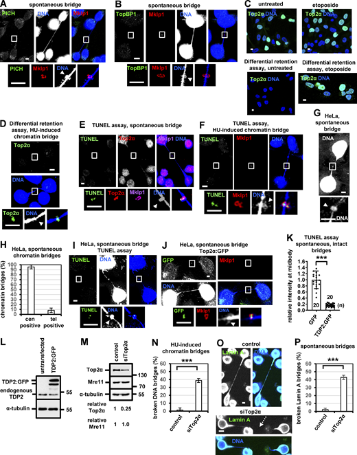 Top2α forms Top2–DNA adducts on DNA knots on HU-induced chromatin bridges. (A and B) Localization of PICH and TopBP1 in BE cells. (C) Localization of Top2α in cells extracted with the differential retention assay protocol or the standard fixation protocol for immunofluorescence, in the absence of treatment (untreated) or after treatment of cells with 10 μM etoposide for 2 h. (D) Localization of Top2α on HU-induced chromatin bridges in cells extracted with the differential retention assay protocol. (E and F) TUNEL staining on spontaneous or HU-induced chromatin bridges. (G) A spontaneous bridge with a DNA knot in HeLa cells. (H) Frequency of chromatin bridges that are positive for cen or tel probes by FISH in HeLa cells. Mean ± SD from three independent experiments (n > 60). (I and J) Localization of double-strand DNA ends (TUNEL) and Top2α:GFP at the bridge DNA next to the midbody in HeLa cells. Midbodies (boxed areas) were reexported and are shown at higher magnification. (K) Mean intensity of TUNEL staining at the bridge DNA next to the midbody in BE cells expressing GFP or TDP2:GFP. Mean ± SD from n cells. Values in GFP were set to 1. Numbers below/next to each bar indicate n. (L) Western blot analysis of total GFP, TDP2, and tubulin in BE cells expressing TDP2:GFP. (M) Western blot analysis of total Top2α, Mre11, and tubulin in untreated (control) cells or cells transfected with Top2α siRNA. (N) Frequency of broken DNA bridges in HU-induced cells. (O) BE cells exhibiting Lamin A bridges in the absence (control) or presence of Top2α siRNA. (P) Frequency of broken Lamin A bridges. Mean ± SD from three independent experiments (n > 120). ***, P < 0.001 (Student’s t test). Broken chromatin bridges are indicated by dotted arrows. Arrowheads indicate DNA knots. Scale bars, 5 μm. Source data are available for this figure: SourceData FS2. Refer to the image caption for details.