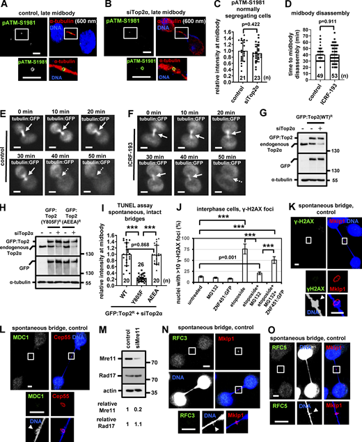 Top2 inhibition does not accelerate midbody disassembly in normally segregating cells. (A–C) Localization and mean intensity of phosphorylated ATM-S1981 (pATM) at the midbody in normally segregating BE cells, in the absence (control) or presence of Top2α siRNA. Tubulin values indicate midbody thickness. Mean ± SD from n cells. Values in control were set to 1. (D–F) Time-lapse microscopy analysis of HeLa cells expressing tubulin:GFP. Cells were untreated (control) or treated with 10 μM ICRF-193 immediately before filming. Midbodies are shown by solid arrows. Time is from midbody formation to midbody disassembly (dotted arrows). (G and H) Western blot analysis of total Top2α, GFP, and tubulin in BE cells expressing siRNA-resistant (R) WT, Y805F, or AEEA GFP:Top2R, in the absence or presence of Top2α siRNA. (I) Mean intensity of TUNEL staining at the bridge DNA next to the midbody in cells expressing WT, Y805F, or AEEA GFP:Top2, in the presence of Top2α siRNA. Mean ± SD from n cells. Values in WT were set to 1. Numbers below/next to each bar indicate n. (J) Frequency of interphase cells exhibiting >10 γ-H2AX foci per nucleus after treatment with 10 μM MG132 and/or 10 μM etoposide for 4 h, in the absence or presence of ZNF451:GFP. Mean ± SD from three independent experiments (n > 300). ***, P < 0.001 (ANOVA and Student’s t test). (K and L) Localization of γ-H2AX or MDC1 in cytokinesis with chromatin bridges. (M) Western blot analysis of total Mre11, Rad17, and actin. (N and O) Localization of RFC3 or RFC5 in BE cells with chromatin bridges. Arrowheads indicate DNA knots. Midbodies (boxed areas) were reexported and are shown at higher magnification. Scale bars, 5 μm. Source data are available for this figure: SourceData FS4. Refer to the image caption for details.