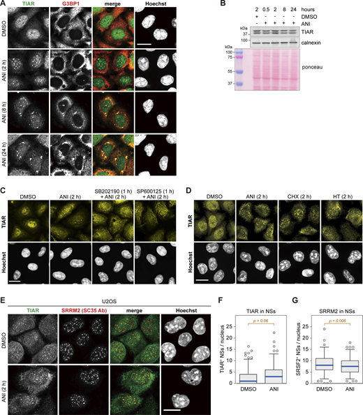 Subcellular localization of TIAR upon ribotoxic stress. (A) HeLa cells were treated with either DMSO or ANI (0.1 µg/ml), and subcellular localization of TIAR was assessed by immunofluorescence (IF) microscopy at indicated time points. The α-G3BP1 signal serves as a marker for stress granules. (B) TIAR protein levels were assessed by Western blot analysis of total protein lysates from HeLa cells treated with DMSO or ANI (0.1 µg/ml) as indicated. Calnexin and total protein staining with Ponceau were used as loading controls. (C) Subcellular localization of TIAR in HeLa cells was determined by IF microscopy after 2-h treatment with DMSO or ANI (0.1 µg/ml), with or without 1-h pre-treatment with the p38 MAPK inhibitor SB202190 (10 µM) or the JNK inhibitor SP600125 (10 µM). The same sample stained with a different primary and secondary antibody is shown in Fig. S3 A. (D) Subcellular localization of TIAR in HeLa cells was determined by IF microscopy after 2-h treatment with ANI (0.1 µg/ml), CHX (100 µg/ml) or HT (2 µg/m). (E) Subcellular localization of TIAR in U2OS cells treated with DMSO or ANI (0.1 µg/ml) for 2 h. The α-SRRM2 (SC35 Ab) signal serves as marker for NSs. In A and C–E, scale bar = 20 µm. (F) Box-and-whisker plots depicting the number of TIAR-positive NSs per nucleus in U2OS cells. An ImageJ macro was used for automated quantification of IF micrographs; N = 3; DMSO (n = 142), ANI (n = 137). (G) The number of SRRM2-positive NSs per nucleus of U2OS cells was quantified as in B; N = 3, DMSO (n = 142), ANI (n = 137). In F and G, P values were determined by two-sided Wilcoxon rank sum test. Source data are available for this figure: SourceData FS2. Refer to the image caption for details.