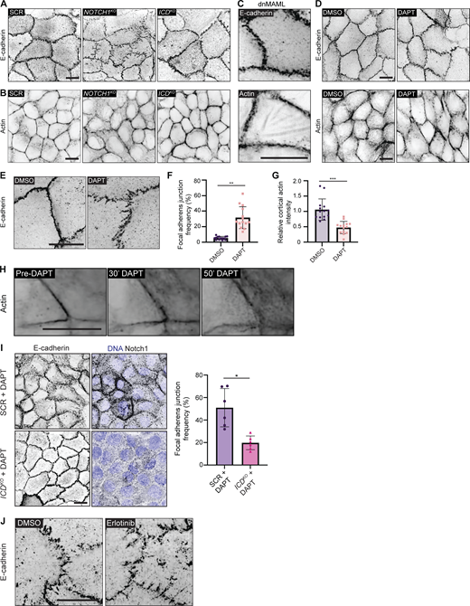 Loss of Notch1 cortical signaling disrupts epithelial adherens junctions and cortical actin organization. (A) Source full field of view fluorescence micrographs of scramble control (SCR), NOTCH1KO, ICDKO, and dnMAML cells immunostained for E-cadherin (black) for representative images in Fig. 3. (B) Source full field of view fluorescence micrographs of SCR, NOTCH1KO, ICDKO, and dnMAML cells labeled with phalloidin (black) for representative images in Fig. 3. (C) SoRa fluorescence micrographs of dnMAML cells labeled with E-cadherin (black) or phalloidin (black). Scale bar, 10 µm. (D) Source full field of view fluorescence micrographs of wild type cells treated with DMSO or 10 µM DAPT for 2 h immunostained for E-cadherin (black, top row) and labeled with phalloidin (black, bottom row) for representative images in D. (E) Fluorescence micrographs of wild type cells treated with DMSO or 10 µM DAPT for 2 h and immunostained with E-cadherin (black). Scale bar, 10 µm. (F) Quantification of the frequency of focal adherens junctions in DMSO and DAPT treated cells. n ≥ 13 fields of view from three independent experiments. (G) Intensity of cortical actin at cell–cell junctions, quantified from phalloidin-stained micrographs of DMSO and DAPT treated cells. n ≥ 13 fields of view from three independent experiments. (H) Fluorescence micrographs of single frames from a timelapse movie of wild type cells labeled with SPY650-FastAct (black) and treated with 10 µM DAPT. (I) Left: Fluorescence micrographs of SCR cells or ICDKO cells treated with 10 µM DAPT for 2 h, immunostained for E-cadherin (black), and Notch1 (black) and labeled with Hoechst (blue). Right: Quantification of the frequency of focal adherens junctions in SCR + DAPT and ICDKO + DAPT treated cells. n = 6 fields of view from three independent experiments. (J) Immunofluorescence micrographs of NOTCH1KO cells treated with DMSO or 1 µM Erlotinib immunostained for E-cadherin (black). All scale bars, 10 µm. For plots F, G, and I, mean ± SEM; two-tailed unpaired t test, *P < 0.05, **P < 0.01, ****P < 0.0001.