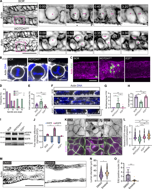 Notch1 cortical signaling regulates epithelial cell architecture and suppresses EGFR mitogenic signaling. (A) Individual time frames from live cell movies of actin within scramble control (SCR) and NOTCH1KO ducts labeled with SPY650-FastAct (black). Inset for individual time frames outlined in magenta in the 0:00 (hour:min) frame. Parent cell is labeled with (*) and daughter cell is labeled with (**). Scale bar, 50 µm. (B) Fluorescence micrographs of dividing SCR, NOTCH1KO, and ICDKO cells in ducts labeled with Hoechst (blue) and phalloidin (white). Scale bar, 10 µm. (C) Maximum projection micrographs of 30 µm medial stacks of SCR, NOTCH1KO, and ICDKO epithelial ducts labeled with phalloidin (magenta) and EdU (green). Scale bar, 30 µm. (D) Quantification of spindle axis angle measured from independent cells in ducts during metaphase as shown in B. Spindle axis angle is measured relative to the basal ECM interface, with 0° denoting a parallel axis. n = 13 spindles from at least three independent ducts. (E) Quantification of the percentage of EdU positive nuclei in ducts. n ≥ 9 independent ducts. (F) YZ orthogonal projections from fluorescence micrographs of SCR, NOTCH1KO, and ICDKO cells labeled with phalloidin (white) and Hoechst (blue). (G) Quantification of regions of cell multilayering per field of view in fluorescence micrographs of SCR, NOTCH1KO, and ICDKO cells. n ≥ 10 fields of view from three independent experiments. (H) Quantification of cell height from SCR, NOTCH1KO, and ICDKO cells plated on hydrogels. n ≥ 10 fields of view from three independent experiments. (I) Western blot of lysates from confluent SCR, NOTCH1KO, and ICDKO cells cultured with high EGF (20 ng/ml) and immunoblotted for pEGFR (Y845), EGFR, and Notch1. (J) Quantification of Western blot intensity difference of pEGFR and total EGFR levels in cells stimulated with high (20 ng/ml) or low (2 ng/ml) EGF. n = 3 independent experiments. (K) Top: Fluorescence micrographs of SCR, NOTCH1KO, and ICDKO cells immunostained for EGFR (black). Bottom: Fluorescence EGFR (magenta) micrograph overlay with phalloidin (green). Scale bar, 10 µm. (L) Quantification of relative junctional to cytoplasmic EGFR intensity. n ≥ 20 cells from three independent experiments. (M) Representative medial confocal slice micrographs of NOTCH1KO ducts treated with DMSO or 1 µM Erlotinib labeled with phalloidin (black). Scale bar, 100 µm. (N) Quantification of duct lumen diameter. Average duct diameters from n ≥ 15 independent ducts. (O) Quantification of the percentage of EdU-positive nuclei in NOTCH1KO cells treated with DMSO or 1 µM Erlotinib. n ≥ 15 fields of view from three independent experiments. Western blots are representative of three independent experiments. For plots D, E, G, H, J, and L, mean ± SEM; one-way ANOVA with Tukey’s post-hoc test, *P < 0.05, **P < 0.01, ***P < 0.001, ****P < 0.0001, ns denotes non-significant. For plots N and O, mean ± SEM; two-tailed unpaired t test, *P < 0.05, ***P < 0.001. Source data are available for this figure: SourceData F2.