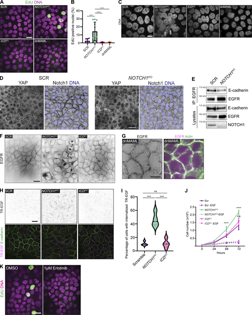 Loss of Notch1 cortical signaling results in aberrant epithelial architecture and proliferation. (A) Fluorescence micrographs of scramble control (SCR), NOTCH1KO, ICDKO, and dnMAML cells labeled with EdU (green) and Hoechst (magenta). Scale bar, 20 µm. (B) Quantification of the percentage of EdU-positive nuclei in SCR, NOTCH1KO, ICDKO, and dnMAML cells. n ≥ 12 fields of view, from three independent experiments. (C) Maximum intensity projection fluorescence micrographs of SCR, NOTCH1KO, ICDKO, and dnMAML cells labeled with Hoechst (grey). Scale bar, 10 µm. (D) Immunofluorescence micrographs of SCR and NOTCH1KO cells immunostained for YAP (white, left) and Notch1 (black, right) and labeled with DAPI (blue, right). Scale bar, 20 µm. (E) Western blot of immunoprecipitation of EGFR from SCR and NOTCH1KO cell lysates immunoblotted for E-cadherin and EGFR. Representative of three independent experiments. (F) Full field of view source fluorescence micrographs of SCR, NOTCH1KO, and ICDKO cells immunostained for EGFR (black) for representative images in Fig. 2. Scale bar, 20 µm. (G) Fluorescence micrographs of dnMAML cells immunostained for EGFR (black, left; magenta, right) and labeled with phalloidin (green, right). Scale bar, 10 µm. (H) Top: Fluorescence micrographs of SCR, NOTCH1KO, and ICDKO cells incubated with TexasRed-EGF (TR-EGF; black). Bottom: Fluorescence micrographs of SCR, NOTCH1KO, and ICDKO cells incubated with TR-EGF (magenta) and labeled with phalloidin (green). Scale bar, 20 µm. (I) Quantification of the percentage of SCR, NOTCH1KO, and ICDKO cells with internalized TR-EGF. Average internalization from n = 4 independent experiments. (J) Cell proliferation rates of SCR, NOTCH1KO, and ICDKO cells treated with and without EGF over a 3-d timecourse. n = 3 independent experiments. (K) Fluorescence micrographs of NOTCH1KO cells treated with DMSO or 1 µM Erlotinib labeled with EdU (green) and Hoechst (pink). Scale bar, 20 µm. For plots B, I, and J, mean ± SEM; one-way ANOVA with Tukey’s post-hoc test, ***P < 0.001, ****P < 0.0001, ns denotes non-significant. Source data are available for this figure: SourceData FS2.