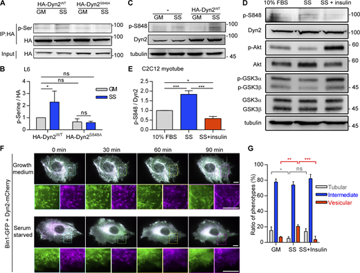 The phosphorylation of Dyn2S848is regulated by insulin signaling. (A and B) Phosphorylation of Dyn2 in response to SS. HA-tagged Dyn2WT or Dyn2S848A expressed in L6 myoblasts were precipitated by anti-HA antibody with or without SS. Phosphorylated Dyn2 was quantified by anti-phospho-serine antibody and normalized with precipitated HA intensity compared with HA-Dyn2WT in growth medium and shown in B (n = 3 experimental replicates). (C–E) Phosphorylation of endogenous Dyn2 in response to SS and insulin. C2C12 myotubes were subjected to growth medium (10% FBS), 3-h serum-free medium (SS; C), or SS followed with 30-min, 100 nM insulin stimulation (D). Cell lysates were harvested and detected by Western blotting with indicated antibodies. The ratio of phosphorylated Dyn2S848 was quantified and shown in E (n = 3 experimental replicates). (F) Time-lapse representative images of Bin1-GFP tubules in cells cotransfected with Dyn2-mCherry and cultured in growth or serum-free medium. Boxed areas were magnified and shown in the lower panel. Scale bar, 10 μm. (G) Effects of insulin signaling on Bin1 tubule morphology. Bin1-GFP were transfected into myoblasts together with Dyn2-mCherry and cultured in growth medium, serum-starved, or starved followed by 60-min insulin stimulation. The population of cells with tubule, intermediate, or vesicular Bin1 morphology were quantified (n ≥ 75 cells from three independent repeats). Scale bar, 10 μm. Data are shown as average ± SD and analyzed with one-way ANOVA. *P < 0.05; **P < 0.01; ***P < 0.001. Molecular weight is in kD. Source data are available for this figure: SourceData F5. Refer to the image caption for details.