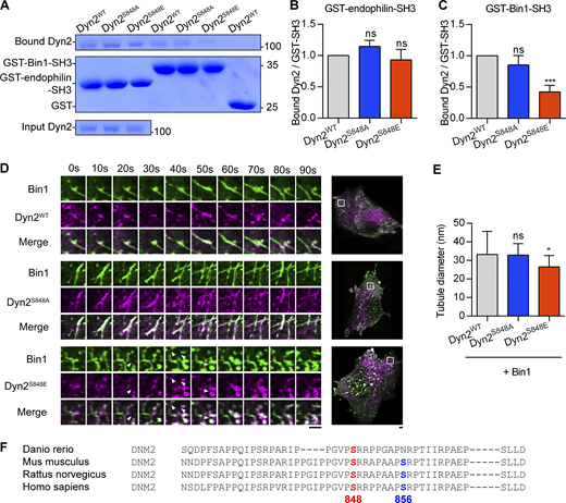Dyn2-Ser848 phosphorylation relieves Bin1 inhibition and promotes membrane fission. (A–C) Binding ability between Dyn2 and different SH3 domain. 12 µg GST, GST-Bin-SH3, or GST-endophilin-SH3 was incubated with 6 µg indicated purified Dyn2. Bound Dyn2 was analyzed with SDS-PAGE and Coomassie Blue staining. The ratio of bound Dyn2 was quantified, normalized to WT, and shown in B and C (n = 3 experimental replicates). Molecular weight is in kD. (D) Time-lapse representative images of Bin1-GFP tubules in cells co-expressing WT, S848A, or S848E Dyn2-mCherry were magnified and shown. White arrowheads indicate the occurrence of membrane fission. Scale bar, 2 µm. (E) Quantification of tubulated liposome diameter from coincubation of Bin1 and Dyn2 in Fig. 3 G (n ≥ 6 liposome tubules). (F) Multiple sequence alignment of Dyn2 PRD domain from different organisms. These sequences were analyzed with EMBL-EBI Clustal Omega Multiple Sequence Alignment. Data are shown as average ± SD and analyzed with one-way ANOVA. *P < 0.05; ***P < 0.001. Source data are available for this figure: SourceData FS2. Refer to the image caption for details.