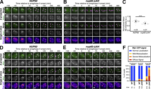 Peripheral Nup60 is required for proper gamete nuclear basket organization. (A and B) Montages of cells with Nup1-GFP, a nuclear basket nucleoporin, and Htb1-mCherry, a histone, progressing through meiosis in either (A) a NUP60 (UB15303) or (B) a nup60-ΔAH (UB30628) genetic background. (C) Quantification of average nuclear envelope intensity of Nup1-GFP during prophase I (defined as 1 h prior to the anaphase I, the presence of two clear Htb1-mCherry lobes) in NUP60 and nup60-ΔAH cells, as shown in A and B. Individual intensity values were normalized to the average nuclear envelope intensity in NUP60 cells. Asterisks indicate significance determined using a Wilcoxon rank sum test (see Table S5 for P values). Sample sizes (n) are the number of cells quantified in each background. (D and E) Montages of cells with Mlp1-GFP, a nuclear basket nucleoporin, and Htb1-mCherry, a histone, progressing through meiosis in either (D) a NUP60 (UB14648) or (E) a nup60-ΔAH (UB30632) genetic background. (F) Quantification of Mlp1-GFP organization for the strains in D and E during prophase I (defined as an hour before the post-MI time point), post-MI (defined as the presence of two clear Htb1-mCherry lobes), and post-MII (defined as 2 h after the presence of four clear Htb1-mCherry lobes). Sample sizes (n) indicate the number of nuclei scored for Mlp1 organization. For panels A, B, D, and E, the white arrowheads in the “Fire LUT” images denote cells after anaphase II when gamete nuclear basket organization or misorganization is apparent. For all panels, the onset of anaphase II was defined by the presence of four Htb1-mCherry lobes. Scale bars, 2 μm. Refer to the image caption for details.