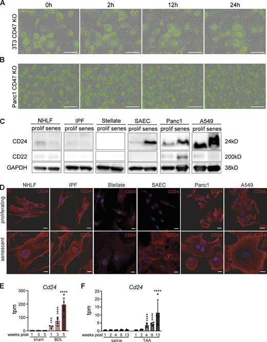 Increased CD24 expression in senescent epithelial cells. (A) Senescent CD47 KO 3T3 cells (labeled with Green Cytolight Rapid Dye) were co-cultured with naïve BMDMs (unstained). Images were taken over 24 h. In each image group, the same field of view was shown across time. Data are representative of three independent experiments; scale bars indicate 200 µm. (B) Senescent CD47 KO Panc1 cells (labeled with Green Cytolight Rapid Dye) were co-cultured with naïve MDMs (unstained). Images were taken over 24 h. In each image group, the same field of view was shown across time. Data are representative of three independent experiments; scale bars indicate 200 µm. (C) Whole-cell lysates from indicated cell types were isolated and analyzed by Western blotting for the indicated proteins. Senescence was induced by chemical treatment. Data are representative of at least two independent experiments. GAPDH images are derived from the same blot as Fig. 7, C and E (SAEC) and Fig. 8 G. CD24 image is derived from the same blot as in Fig. 8 G. (D) Representative immunofluorescence images from indicated cell types (proliferating or senescent) stained for CD24 (red) and Hoechst (blue). Scale bars indicate 20 µm. n = 2. (E and F) Expression levels obtained from RNA-sequencing data for liver fibrosis rat models (Wang et al. 2021). Transcripts per million (tpm) expression values for Cd24 in rat livers derived from bile duct ligation (BDL; E) or thioacetamide (TAA)-induced liver fibrosis (F). Data are represented as mean ± SEM. Significant de-regulation (***P < 0.0005, ****P < 0.0001) was determined by limma/voom based on counts derived from featureCounts. Source data are available for this figure: SourceData FS3.
