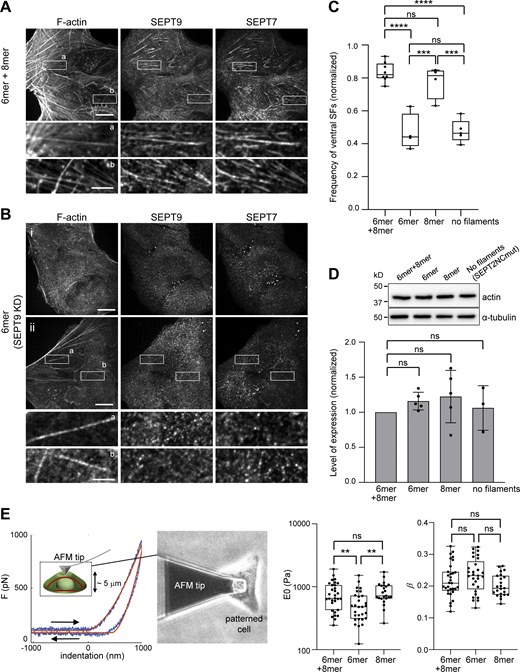 Ventral SFs are significantly reduced in the absence of octamers or upon impairing septin polymerization. (A) Representative confocal micrograph of cells co-stained for SEPT7, SEPT9, and F-actin (phalloidin). Examples show septins localizing to ventral SFs (a and b). (B) Representative confocal micrographs of wild type U2OS cells treated with siRNA targeting SEPT9 and co-stained for SEPT7, SEPT9, and F-actin (phalloidin). Example (i) depicts cells with no ventral SFs, whereas example (ii) shows cells that have ventral SFs that are devoid of septins (a and b; see Materials and methods for classification). (C) Box plots showing the frequency of ventral SF presence in wild-type cells treated with siRNA targeting LacZ (6mer+8mer), siRNA targeting SEPT9 (6mer), siRNA targeting SEPT7 and co-transfected with msfGFP-SEPT7Gmut2 (8mer), and siRNA targeting SEPT2 and co-transfected with SEPT2NCmut-msfGFP (no filaments). The data points are plotted on top of the respective box plots; each data point corresponds to one round of experiments. On each box, the central mark indicates the median, and the bottom and top edges of the box indicate the 25th and 75th percentiles, respectively. The whiskers extend to the minimum and maximum values. The number of cells analyzed per experiment in each box plot, from left to right, is n = 46; 87; 104; 152; 18; 31; 26; 12 (6mer+8mer), n = 51; 83; 117; 165 (6mer), n = 66; 79; 84; 82 (8mer), and n = 99; 60; 67; 84; 51 (no filaments). The respective median frequencies are 82% (6mer+8mer), 44% (6mer), 81% (8mer), and 46% (no filaments). One-way ANOVA; ns = not significant; *** P < 0.001, **** P < 0.0001. (D) Top: Western blots of cell lysates probed with anti-actin and anti-α-tubulin antibodies under the same conditions as in C. Molecular weight markers are shown on the left. Bottom: Respective quantification of actin protein levels (mean + SD). Mean values (normalized to 1 for 6mer+8mer) are from three to five independent experiments. One-way ANOVA; ns = not significant. (E) Atomic force microscopy nanoindentation on cells under the conditions “6mer+8mer,” “6mer,” and “8mer” as described in C. Left: Example of an experimental force-indentation curve. Right and left arrows correspond to the approach and retraction curves, respectively. The solid red lines represent the fits to the viscolelastic model (see Materials and methods). The inset depicts the indentation of the cell, also showing ventral and dorsal SFs in red. The image on the right shows the cantilever tip indenting the dorsal membrane of a micropatterned wild-type cell. Right: Box plots showing the distributions of cell stiffness (E0) and cell fluidity (β). E0 values are plotted on a log scale. The data points are plotted on top of the respective box plots; each data point corresponds to one cell. On each box, the central mark indicates the median, and the bottom and top edges of the box indicate the 25th and 75th percentiles, respectively. The whiskers extend to the minimum and maximum values. The number of measurements in each box plot, from left to right, is n = 31, 29, 23. The respective median cell stiffness values are 656, 479, and 719 Pa, and the respective median cell fluidity values are 0.21, 0.23, and 0.19. One-way ANOVA for log(E0) and for β; ns = not significant; ** P < 0.01. Source data are available for this figure: SourceData F8. Refer to the image caption for details.