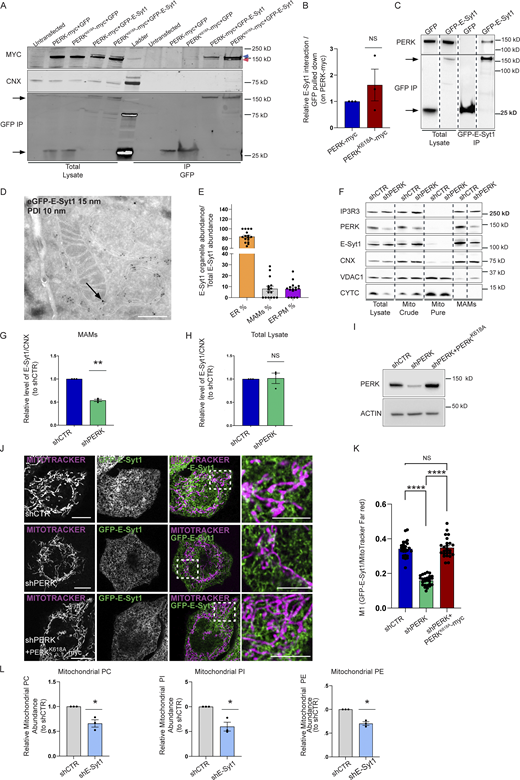 PERK recruits the lipid transfer protein E-Syt1 at the EMCS. (A) Representative immunoblot for myc, GFP, and CNX after GFP pull-down showing PERK-E-Syt1 interaction in HEK293-T cells transiently co-transfected with myc-tagged PERK full-length (FL) or myc-tagged PERK kinase dead mutant (PERKK618A) and with eGFP-empty vector or eGFP-tagged E-Syt1. Untransfected cells are shown as negative control. In the eGFP-E-Syt1 transfected cells, a residual GFP signal is still visible as upper band (blue arrow) above PERK (red arrow) in the anti-myc panel. (B) Quantification of the PERK-E-Syt1 interaction normalized on GFP-pulled down and relative to control condition (PERK-myc). The values plotted are the mean ± SEM from three biological replicates analyzed using one sample t test. (C) Representative immunoblot for eGFP and PERK showing the interaction of PERK and E-Syt1 in HEK293-T cells transiently transfected with eGFP-empty vector or eGFP-tagged E-Syt1. Arrows indicate GFP signals for eGFP-empty vector and eGFP-E-Syt1 pulled down. (D) Representative electron micrograph of ultrathin cryosections of HeLa cells transfected with eGFP-E-Syt1 and immunogold stained with anti-GFP (15 nm gold particles) and anti-PDI (10 nm gold particles). Black arrow denotes E-Syt1 detection at the sites of juxtaposition between the ER and the mitochondria membranes, while PDI, a general ER marker, remains in the ER lumen. Scale bar, 500 nm. (E) Relative quantification of the cellular distribution of E-Syt1 in the ER, EMCS (MAMs), and plasma membrane (PM). The values plotted are the mean ± SEM (n = 16 cellular profiles). (F) Representative immunoblot for IP3R3, PERK, E-Syt1, CNX, VDAC1 and CYTC from total lysates, crude mitochondrial fraction (mito crude), purified mitochondrial fraction (mito pure) and MAM fraction of shCTR and shPERK HeLa cells. (G and H) Quantification of E-Syt1 level at MAMs (G) and total lysate (H) normalized on CNX levels and relative to control condition (shCTR). The values plotted are the mean ± SEM from three biological replicates analyzed using one sample t test. (I) Representative immunoblot for PERK in shCTR, shPERK, and shPERK + PERKK618A HeLa cells. ACTIN serves as loading control. (J) Representative images from eGFP-E-Syt1 transiently transfected and co-stained with MitoTracker Far Red in shCTR, shPERK and shPERK + PERKK618A HeLa cells. Scale bar in overview image is 10 µm, and scale bar in magnification is 5 µm. (K) Colocalization analysis of E-Syt1 and MitoTracker Far Red in shCTR, shPERK and shPERK + PERKK618A HeLa cells (Manders M1 coefficient). The values plotted are the mean ± SEM from three biological replicates (n = 26, n = 26, and n = 25 for shCTR, shPERK, and shPERK + PERKK618A respectively) analyzed using one-way ANOVA, with Tukey’s test for multiple comparisons. (L) Abundance of PC, PI, PE from purified mitochondrial fractions of shCTR and shE-Syt1 HeLa cells, relative to control condition (shCTR). The values plotted are the mean ± SEM from three biological replicates analyzed using one sample t test. *, P < 0.05; **, P < 0.01; ****, P < 0.0001; and NS = not significant. Source data are available for this figure: SourceData F3.