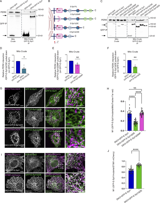 PERK mediates E-Syt1 localization at the EMCS through E-Syt1 C2D-C2E domain. (A) Representative immunoblot for eGFP and PERK showing PERK-E-Syt1 interaction from mito crude fractions in DKO HeLa cells transiently transfected with eGFP-empty vector or eGFP-tagged E-Syt1. Arrows indicate GFP signals for eGFP-empty vector and eGFP-E-Syt1 pulled down. (B) Schematic representation of the E-Syt1 mutants anchored at the ER membrane used in this study; E-Syt1 full length (FL), E-Syt1-ΔSMP, E-Syt1-ΔDE, and E-Syt1-ΔCDE. (C) Representative immunoblot for eGFP and PERK showing PERK-E-Syt1 interaction from mito crude fractions in DKO HeLa cells transiently transfected with eGFP-empty vector or eGFP-tagged E-Syt1, E-Syt1-ΔCDE, E-Syt1-ΔSMP, and E-Syt1-ΔDE. (D–F) Quantification of PERK interaction normalized on E-Syt1-ΔCDE (D), E-Syt1-ΔSMP (E), or E-Syt1-ΔDE (F) eGFP pulled down and relative to control condition (eGFP-E-Syt1). The values plotted are the mean ± SEM from four biological replicates analyzed using one sample t test. (G) Representative images from eGFP-E-Syt1 full length, eGFP-E-Syt1-ΔDE or eGFP-E-Syt1-ΔSMP transiently transfected and co-stained with MitoTracker Far Red in DKO HeLa cells. Scale bar in overview image is 10 µm, and scale bar in magnification is 5 µm. (H) Colocalization analysis of eGFP-E-Syt1/eGFP-E-Syt1-ΔDE/eGFP-E-Syt1-ΔSMP and MitoTracker Far Red in DKO HeLa cells (Manders M1 coefficient). The values plotted are the mean ± SEM from three biological replicates (n = 24, n = 32, and n = 30 for eGFP-E-Syt1, eGFP-E-Syt1-ΔDE, and eGFP-E-Syt1-ΔSMP respectively) analyzed using one-way ANOVA, with Tukey’s test for multiple comparisons. (I) Representative images from eGFP-E-Syt1 full length or eGFP-E-Syt1-ΔDE transiently co-transfected with STIM1-mCherry in DKO HeLa cells. Scale bar in overview image is 10 µm, and scale bar in magnification is 5 µm. (J) Colocalization analysis of eGFP-E-Syt1/eGFP-E-Syt1-ΔDE and STIM1-mCherry in DKO HeLa cells (Manders M1 coefficient). The values plotted are the mean ± SEM from three biological replicates (n = 28 and n = 25 for eGFP-E-Syt1 and eGFP-E-Syt1-ΔDE, respectively) analyzed using unpaired Student’s t test. *, P < 0.05; **, P < 0.01; ****, P < 0.0001; and NS = not significant. Source data are available for this figure: SourceData F4. Refer to the image caption for details.