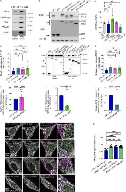 E-Syt1 interacts through its C2D-C2E domain with PERK. (A) Representative immunoblot for IP3R3, GFP, PERK, CNX, VDAC1, and CYTC from total lysate and mito crude fractions of DKO HeLa cells transiently transfected with eGFP-E-Syt1. (B and C) Representative immunoblot (B) for E-Syt1 and GFP in WT HeLa cells transiently transfected with eGFP and DKO HeLa cells transiently transfected with eGFP, eGFP-E-Syt1, eGFP-E-Syt1-ΔDE, eGFP-E-Syt1-ΔSMP, eGFP-E-Syt1-ΔCDE; quantification (C) of E-Syt1 expression levels normalized on ACTIN (loading control) in WT, DKO + E-Syt1, DKO + E-Syt1-ΔDE, DKO + E-Syt1-ΔSMP, or DKO + E-Syt1-ΔCDE HeLa cells. The values plotted are the mean ± SEM from three biological replicates using one-way ANOVA, with Tukey’s test for multiple comparisons. Arrows indicate GFP signals for eGFP-empty vector and eGFP-E-Syt1 mutants transfected and E-Syt1 signals for E-Syt1 endogenous and eGFP-E-Syt1 mutants transfected. (D) Abundance of GFP pulled-down normalized on abundance of GFP in mito crude fraction in DKO HeLa cells transiently transfected with eGFP-tagged E-Syt1, E-Syt1-ΔCDE,E-Syt1-ΔSMP, and E-Syt1-ΔDE. The values plotted are the mean ± SEM from four biological replicates analyzed using one-way ANOVA, with Tukey’s test for multiple comparisons. (E) Representative immunoblot for GFP and PERK showing PERK-E-Syt1 interaction from total lysate in HEK293-T cells transiently transfected with eGFP-empty vector or eGFP-tagged E-Syt1, E-Syt1-ΔSMP, E-Syt1-ΔDE, and E-Syt1-ΔCDE. Arrows indicate GFP signals for eGFP-empty vector and eGFP-E-Syt1 mutants pulled down. (F) Abundance of GFP pulled-down normalized on abundance of GFP in total cell lysates in HEK293-T cells transiently transfected with eGFP-tagged E-Syt1, E-Syt1-ΔSMP, E-Syt1-ΔDE, and E-Syt1-ΔCDE. The values plotted are the mean ± SEM from biological replicates analyzed using one-way ANOVA, with Tukey’s test for multiple comparisons. (G–I) Quantification of PERK interaction normalized on E-Syt1-ΔSMP (G), E-Syt1-ΔDE (H), or E-Syt1-ΔCDE (I) eGFP-pulled down and relative to control condition (eGFP-E-Syt1). The values plotted are the mean ± SEM from three biological replicates analyzed using one sample t test. (J) Representative images from eGFP-E-Syt1 full length or eGFP-E-Syt1-ΔDE transiently co-transfected with STIM1-mCherry in PERK+/+ and PERK−/− MEFs cells. Scale bar, 10 µm. (K) Colocalization analysis of eGFP-E-Syt1/eGFP-E-Syt1-ΔDE and STIM1-mCherry in PERK+/+ and PERK−/− MEFs cells (Manders M1 coefficient). The values plotted are the mean ± SEM from three biological replicates (n = 30, n = 29, n = 30, and n = 27 for PERK+/++E-Syt1-GFP, PERK+/++E-Syt1ΔDE, PERK−/− + E-Syt1-GFP, and PERK−/− + E-Syt1ΔDE, respectively) analyzed using one-way ANOVA, with Tukey’s test for multiple comparisons. **, P < 0.01; ****, P < 0.0001; and NS = not significant. Source data are available for this figure: SourceData FS4.