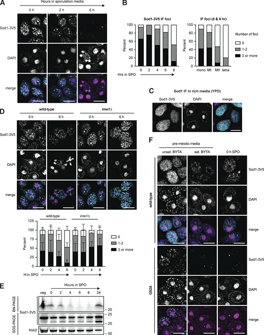 Pre-meiotic Sod1 aggregates naturally occur and are cleared during the meiotic program. (A) Immunofluorescence (IF) staining for Sod1 in cells fixed after 0, 2, and 6 h in sporulation media. (B) Quantification of the number of Sod1-3V5 IF foci in individual cells after 0–8 h in sporulation media (left) and quantification of IF signal appearance in mononucleate (mono, n = 152), meiosis I (MI, n = 67), meiosis II (MII, n = 82), and tetranucleate (tetra, n = 53) cells from 6- and 8-h samples (right). Data show 0 h (n = 134), 2 h (n = 158), 4 h (n = 135), 6 h (n = 191), and 8 h (n = 163) cells harvested from a single experiment. (C) IF staining for wild-type Sod1 in rich media (YPD) during exponential growth. (D) IF staining for Sod1 in wild-type and ime1∆ cells after 0 and 6 h in sporulation media. Quantification of Sod1 IF foci in wild-type and ime1∆ cells fixed after 0–6 h in sporulation media is shown below. Quantification was performed for three experimental replicates (n = 100 cells per time point per replicate). Error bars indicate standard deviation between replicates. (E) Blue native PAGE (BN-PAGE) and SDS-PAGE immunoblotting for Sod1 during a meiotic time course. (F) IF staining for wild-type and G92A mutant Sod1-3V5 in pre-meiotic (unsaturated and saturated BYTA) and meiotic media (0 h SPO). Identical exposure conditions were used during image acquisition, but post-acquisition exposures are different for wild-type and G92A micrographs to improve the visibility of G92A protein. All scale bars = 5 µm. Source data are available for this figure: SourceData F6.