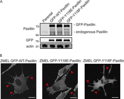 Y118-Paxillin mutants localize to focal adhesion structures in ZMEL cells in the in vitro cell culture conditions. (A) Western blot revealing relative expression levels of endogenous Paxillin (top panel) and GFP-tagged Paxillin (top panel and middle GFP panel) in ZMEL cells overexpressing mutant and wildtype variants of GFP-tagged Paxillin. Actin is used as a loading control. (B) Representative live images of ZMEL cells expressing GFP-WT/Y118E/Y118F-Paxillin in the in vitro cell culture conditions. Red arrowheads indicate Paxillin-positive focal adhesion structures. Scale bar is 10 µm. Source data are available for this figure: SourceData FS3.