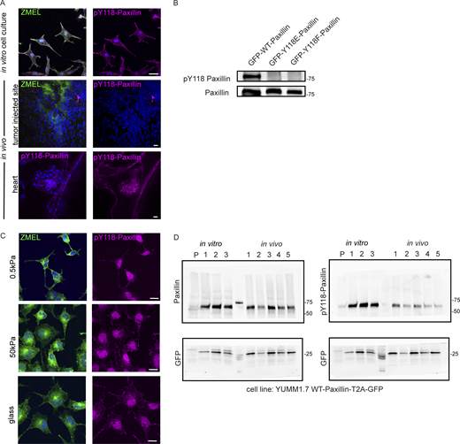 Y118-Paxillin exhibits distinct phosphorylation status in migrating cancer cells in vivo versus in vitro. (A) Top: pY118-Paxillin immunostaining (magenta) of ZMEL-GFP (GFP immunostaining, green) plated on in vitro cell culture dishes. Middle: pY118-Paxillin immunostaining (magenta) of ZMEL-mCherry (mCherry immunostaining, pseudo-colored green) in larval zebrafish (3 d post-transplantation). Bottom: pY118-Paxillin immunostaining (magenta) of the zebrafish developing heart (5 dpf). (B) Western blot showing the specificity of the pY118-Paxillin antibody and that it does not recognize Y118E-Paxillin and Y118F-Paxillin. (C) Representative images of ZMEL-GFP cells plated on 2D surfaces of different stiffnesses (left) and stained for pY118-Paxillin (right). (D) Unmodified Western blot of panels shown in Fig. 3 C—YUMM1.7 cells plated in culture and YUMM1.7 melanoma tumors in vivo blotted with Paxillin and pY118-Paxillin antibodies. “P” is parental cell line with no GFP expression. GFP was used as the loading control and as a control for the number of YUMM1.7 cells in mouse tumors. Source data are available for this figure: SourceData FS2.