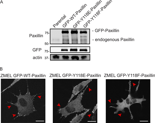Y118-Paxillin mutants localize to focal adhesion structures in ZMEL cells in the in vitro cell culture conditions. (A) Western blot revealing relative expression levels of endogenous Paxillin (top panel) and GFP-tagged Paxillin (top panel and middle GFP panel) in ZMEL cells overexpressing mutant and wildtype variants of GFP-tagged Paxillin. Actin is used as a loading control. (B) Representative live images of ZMEL cells expressing GFP-WT/Y118E/Y118F-Paxillin in the in vitro cell culture conditions. Red arrowheads indicate Paxillin-positive focal adhesion structures. Scale bar is 10 µm. Source data are available for this figure: SourceData FS3.