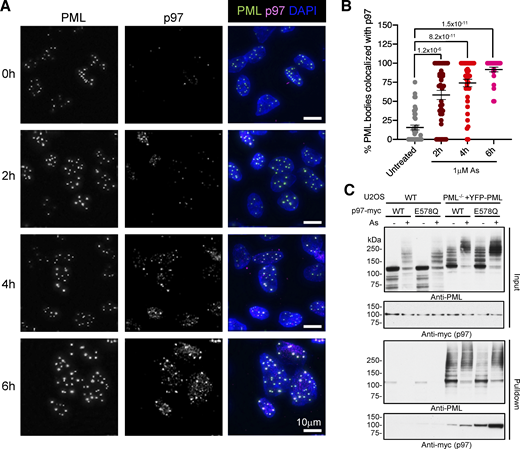 P97 is recruited to PML bodies in response to arsenic. U2OS PML−/− + YFP-PML cells were treated with arsenic for the times indicated, pre-extracted as described in Materials and methods, fixed, and stained with an antibody to p97. (A) Images of p97 (green), YFP-PML (red), and DAPI (blue) are shown. Scale bars are 10 μm. (B) The percentage of PML bodies colocalized with p97 was plotted against time of arsenic treatment. Chart shows individual cell data. Bars represent mean with SEM. P values are two-tailed Mann-Whitney U test derived by comparison with untreated. Cell count n = 41 (untreated), n = 38 (2 h), n = 38 (4 h), and n = 25 (6 h). (C) WT U2OS cells or PML−/− + YFP-PML U2OS cells were transfected with plasmids expressing myc-p97 constructs of either WT or E578Q mutant form and either treated or not with 1 μM arsenic for 6 h. Nuclear extracts (Input) or YFP-PML purifications (Pulldown) were blotted for PML or Myc. Molecular weight markers are indicated in kD. Source data are available for this figure: SourceData F4.