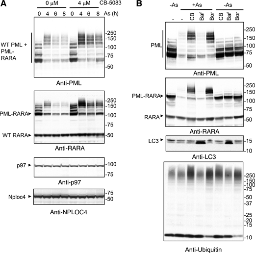 Arsenic-induced degradation of the PML/RARA oncoprotein requires p97. (A) NB4 cells were treated with the indicated concentrations of CB-5083 and exposed to arsenic (As) for the indicated time (h). Cell lysates were analyzed by Western blotting using an antibody to PML, RARA, p97, and NPLOC4. (B) NB4 cells were either untreated (−), treated with CB-5083 (CB), bafilomycin (Baf), or bortezomib (Bor). Response to arsenic (6 h) was investigated for all conditions. Cell lysates were analyzed by Western blotting using antibodies to PML, RARA, LC3, or ubiquitin. Molecular weight markers are indicated in kD. Source data are available for this figure: SourceData F7. Refer to the image caption for details.