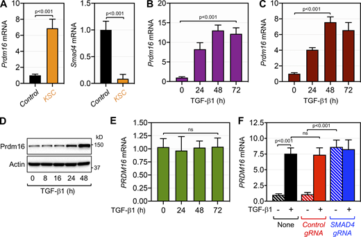 Smad4 represses Prdm16 expression. (A) Expression of Prdm16 (left) or Smad4 (right) in pancreas from 4-mo-old control and KSC mice (n = 6) was analyzed by qRT-PCR. (B) Expression of Prdm16 mRNA in KPC1 cells cultured in the presence or absence of TGF-β1 for various times was analyzed by qRT-PCR (n = 6). (C) Expression of PRDM16 mRNA in PANC-1 cells treated with TGF-β1 for various times was analyzed by qRT-PCR (n = 6). (D) Expression of Prdm16 protein in PANC-1 cells treated with TGF-β1 for various times was analyzed by immunoblotting. (E) Expression of PRDM16 mRNA in MIA-PaCa-2 cells cultured in the presence or absence of TGF-β1 for various times was analyzed by qRT-PCR (n = 6). (F) Expression of PRDM16 mRNA in isogenic PANC-1 cell lines stably transduced with control or SMAD4 gRNA lentiviruses and cultured in the presence or absence of TGF-β1 was analyzed by qRT-PCR (n = 6). Data in A–C, E, and F are expressed as mean ± SEM, and statistical power was assessed by a two-tailed, unpaired t test. Source data are available for this figure: SourceData F5.
