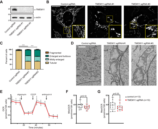 TMEM11 is required for maintenance of normal mitochondrial morphology. (A) Western blot analysis of whole cell lysates from U2OS CRISPRi cells expressing scrambled control sgRNA or sgRNAs targeting TMEM11 and probed with the indicated antibodies. (B) Deconvolved maximum intensity projections of fluorescence microscopy images are shown of U2OS CRISPRi cells stably expressing the indicated sgRNAs and stained with the mitochondrial dye Mitotracker Deep Red. Insets correspond to dotted boxes. Scale bars = 15 µm (3 µm on magnification). (C) A graph of the categorization of mitochondrial morphology from cells as in B. Data shown represent ∼100 cells per condition in each of three independent experiments and bars indicate SEM. Asterisks (***P < 0.001) represent unpaired two-tailed t test. (D) Representative electron micrographs of mitochondria from CRISPRi cells expressing the indicated sgRNA. Scale bar = 1 µm. (E) Representative OCR in CRISPRi cells expressing control sgRNA (gray) or TMEM11 sgRNA #3 (red) from the indicated number of replicates. Mitochondrial inhibitors were injected at the indicated timepoints. (F and G) Quantification of basal mitochondrial OCR (F) and maximal (post-CCCP) OCR (G) in the indicated cell lines. Statistical significance (F and G) was assessed using a two-tailed t test. Source data are available for this figure: SourceData F1. Refer to the image caption for details.